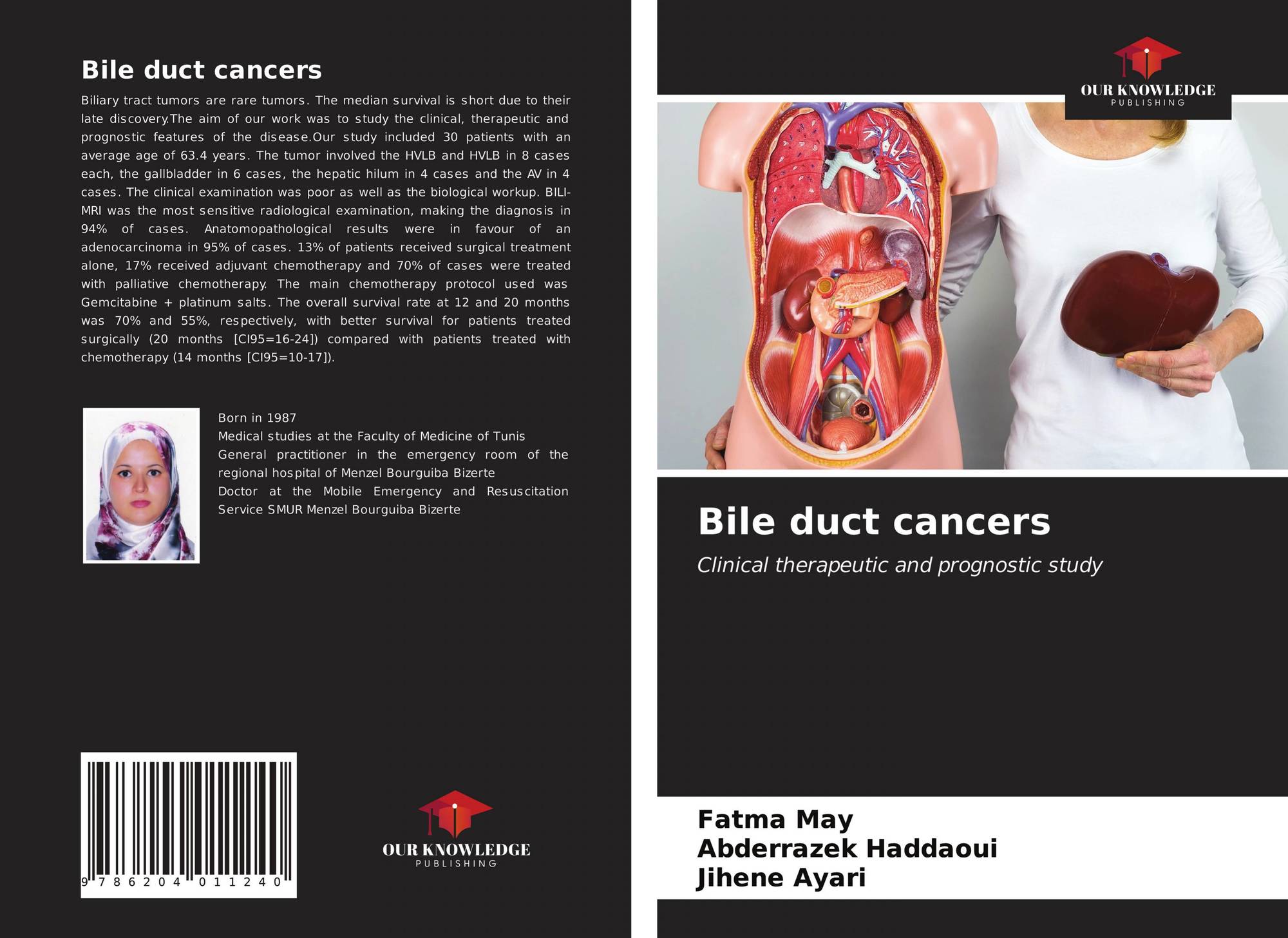 bookcover of bile duct cancers