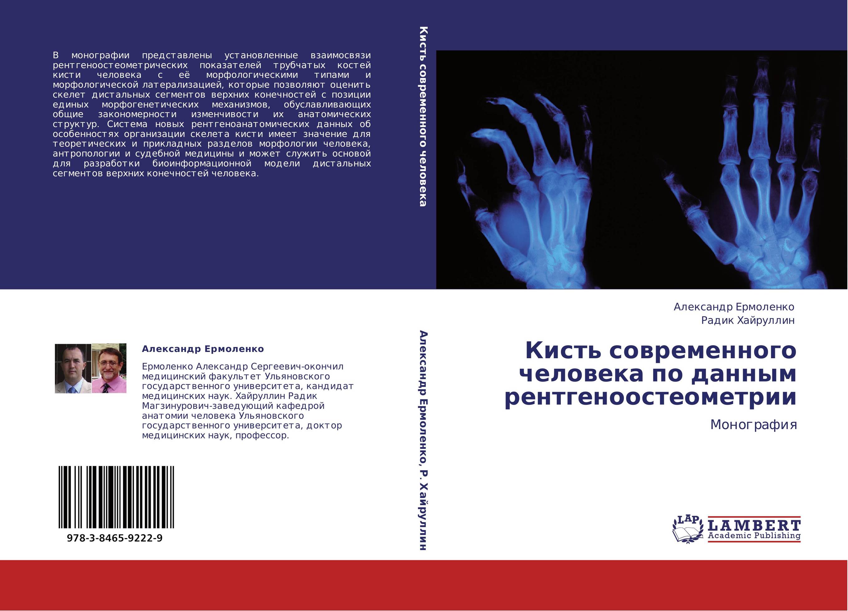 Кисть современного человека по данным рентгеноостеометрии. Монография.