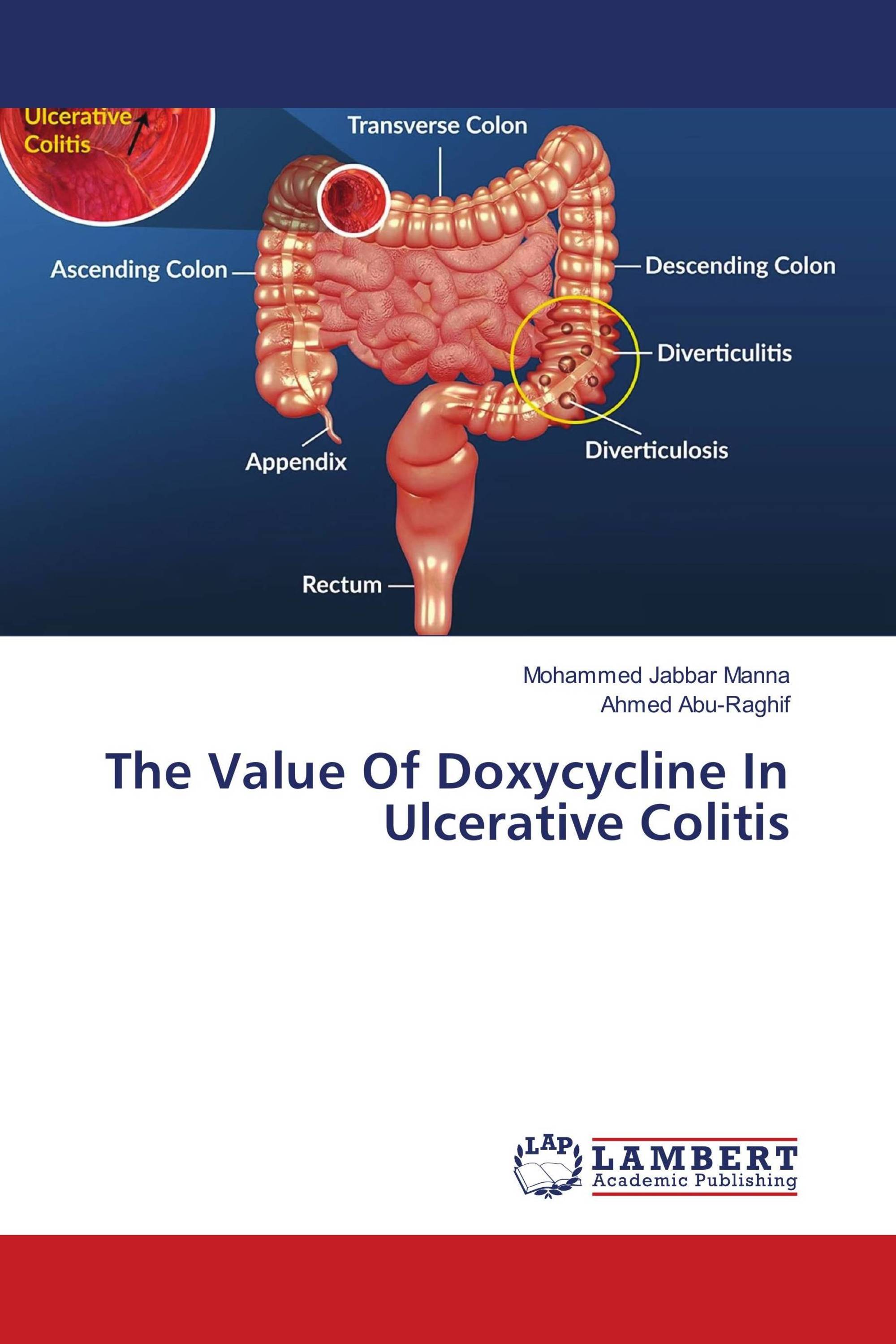 The Value Of Doxycycline In Ulcerative Colitis