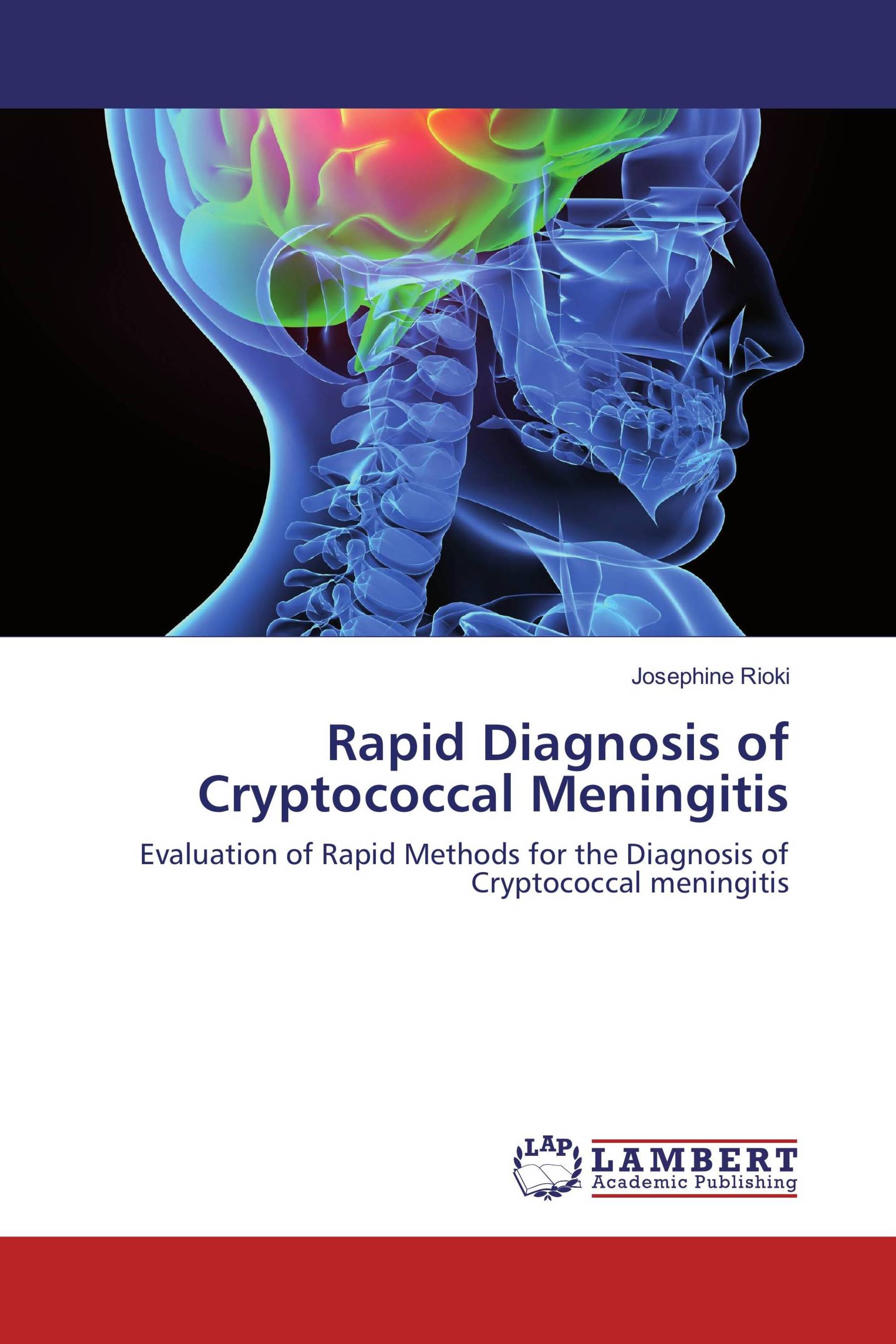 Rapid Diagnosis of Cryptococcal Meningitis / 9783330055155