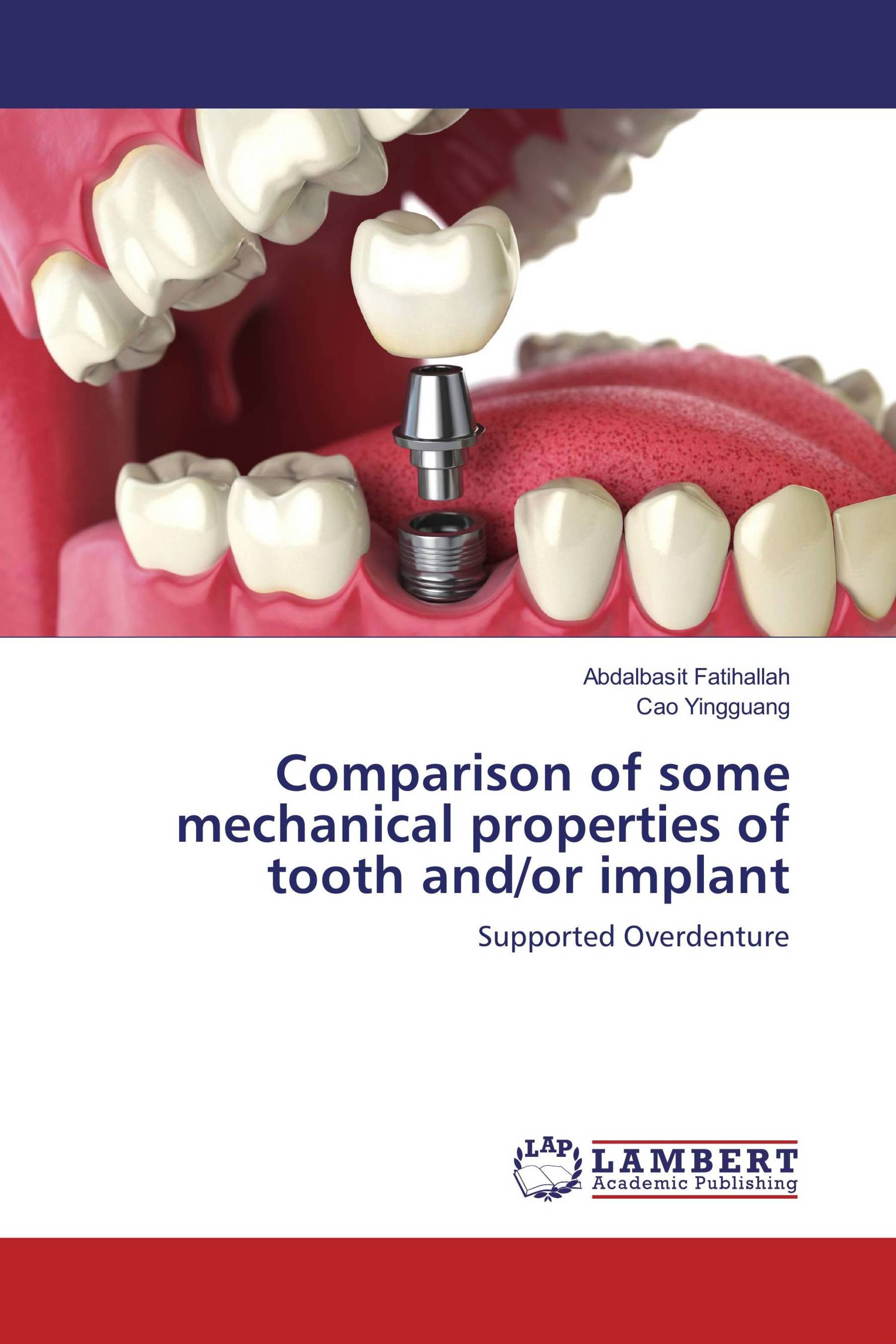 Comparison of some mechanical properties of tooth and/or implant