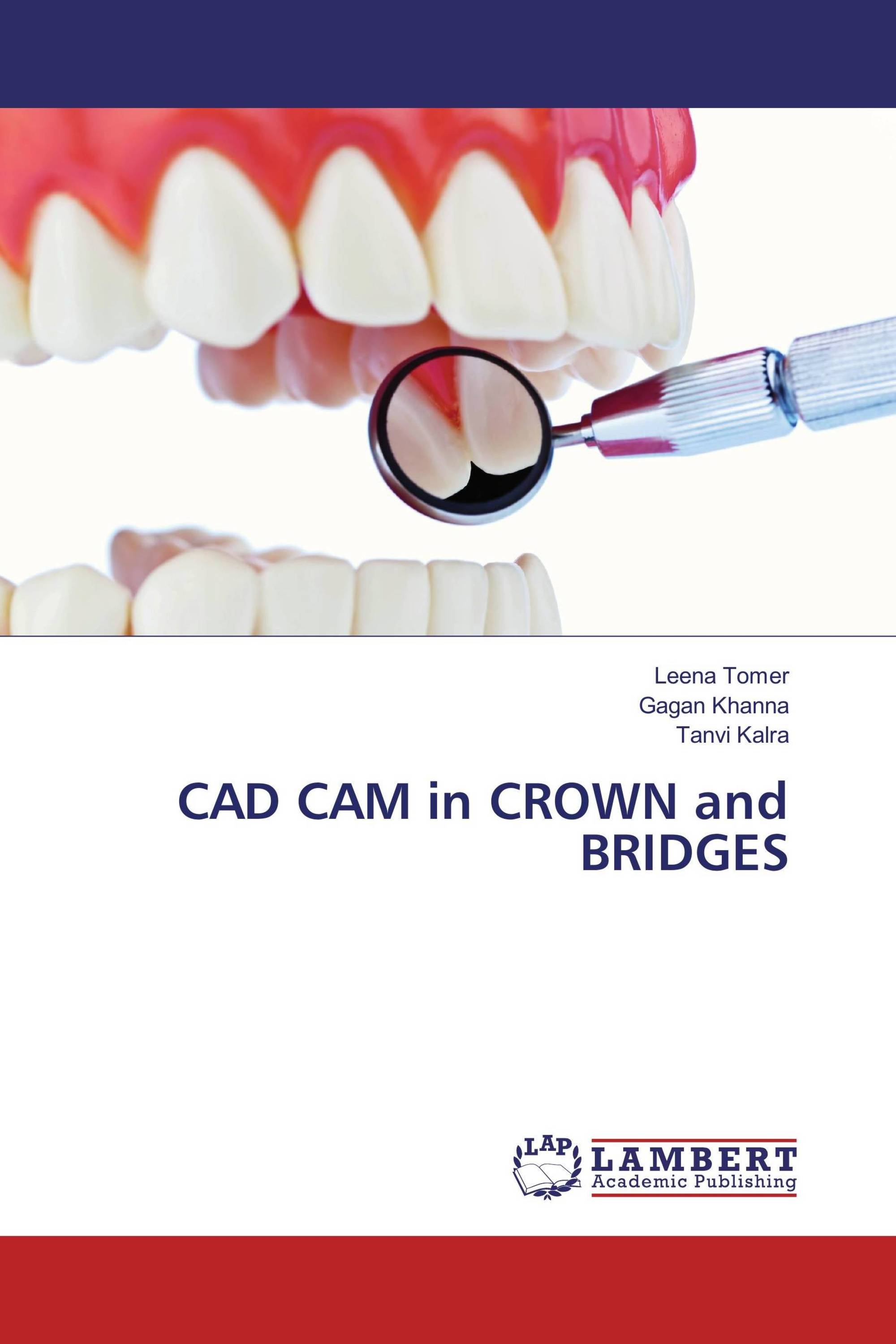 CAD CAM in CROWN and BRIDGES