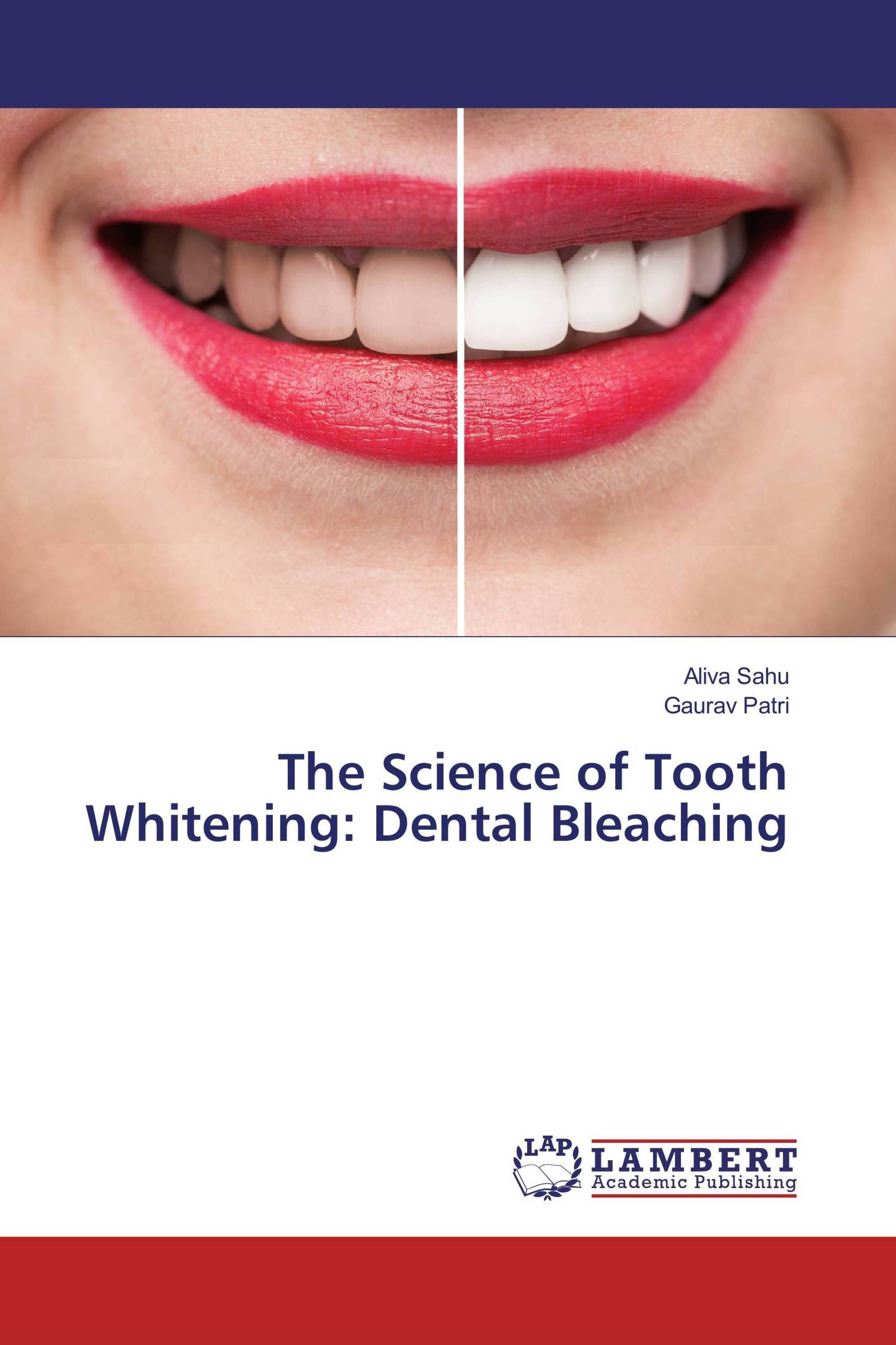 The Science of Tooth Whitening: Dental Bleaching