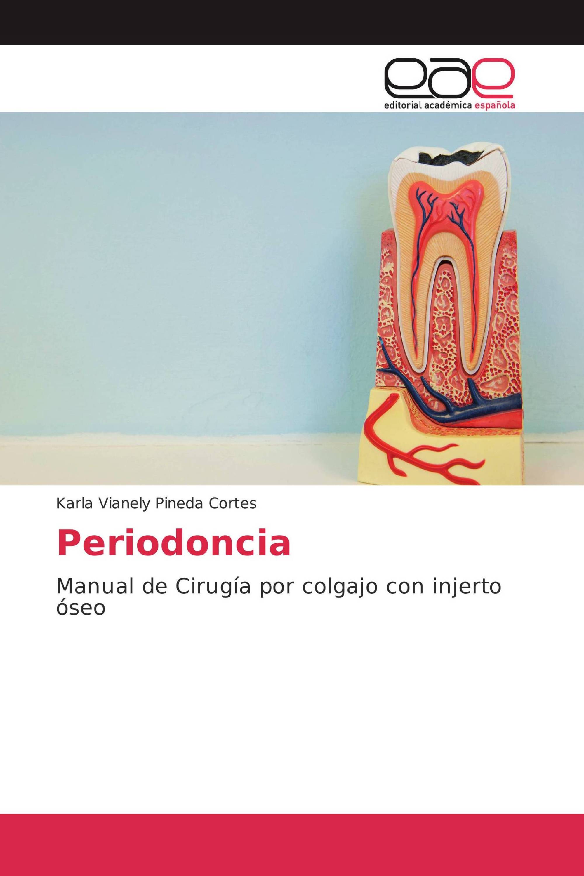 Periodoncia