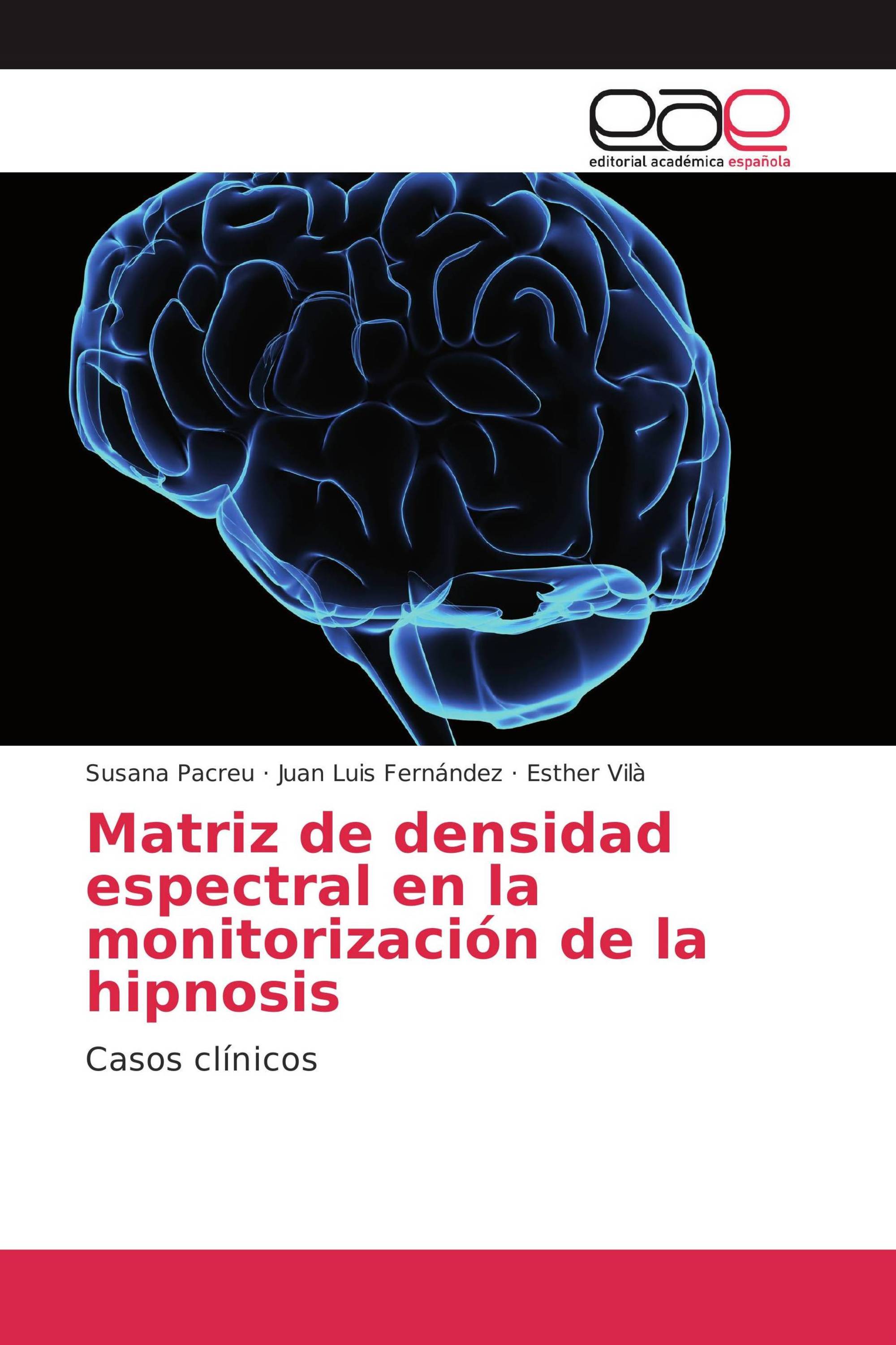 Matriz de densidad espectral en la monitorización de la hipnosis