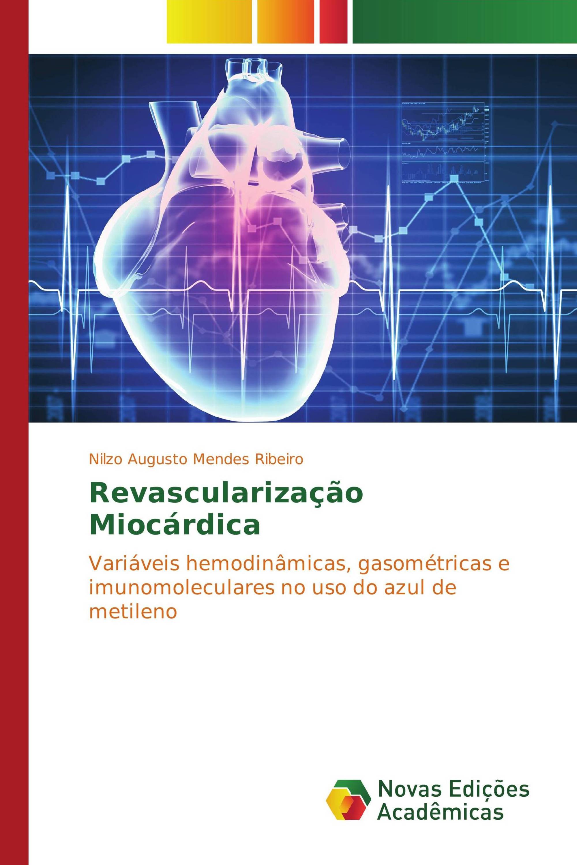 Revascularização Miocárdica