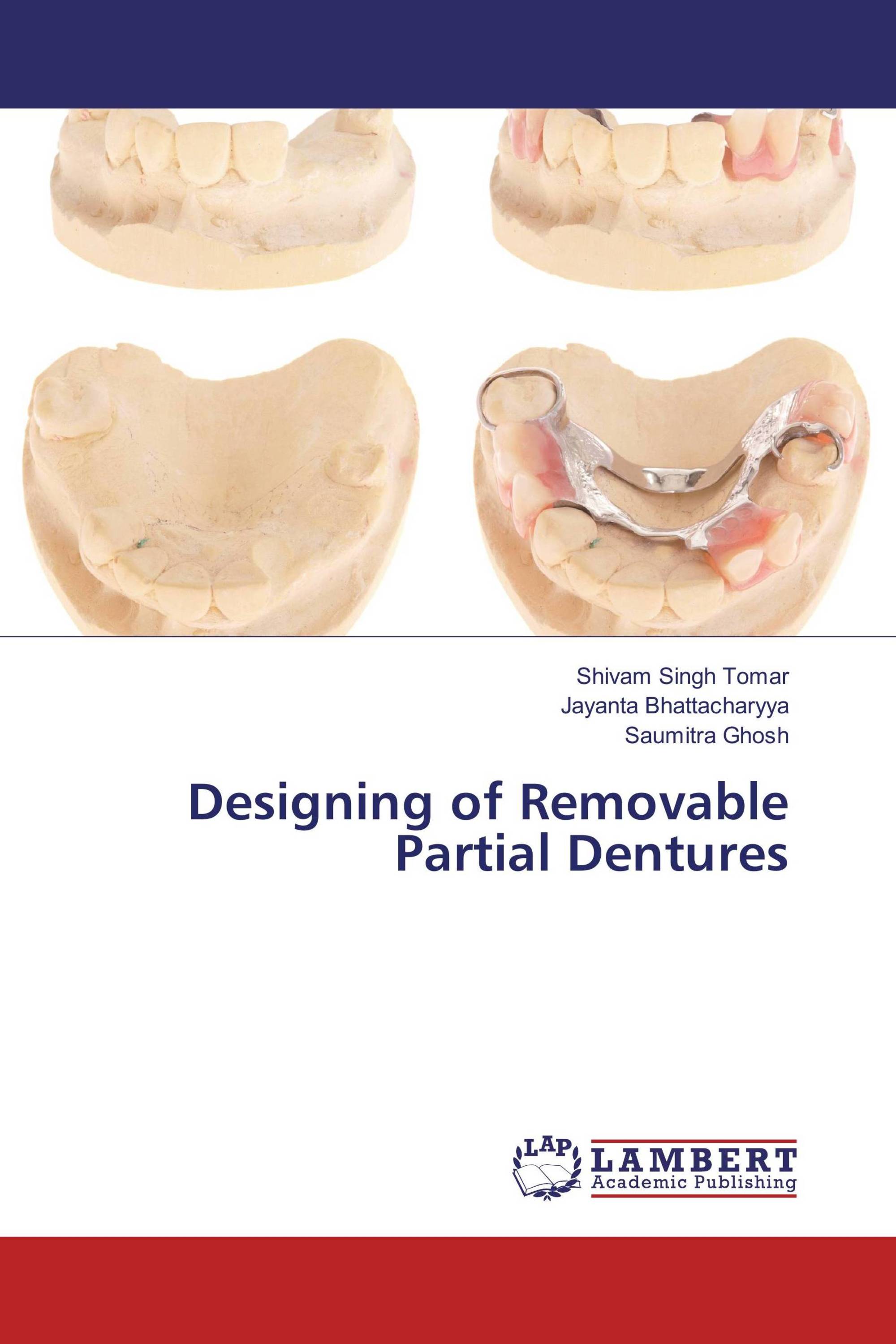 Designing of Removable Partial Dentures / 9783330319127