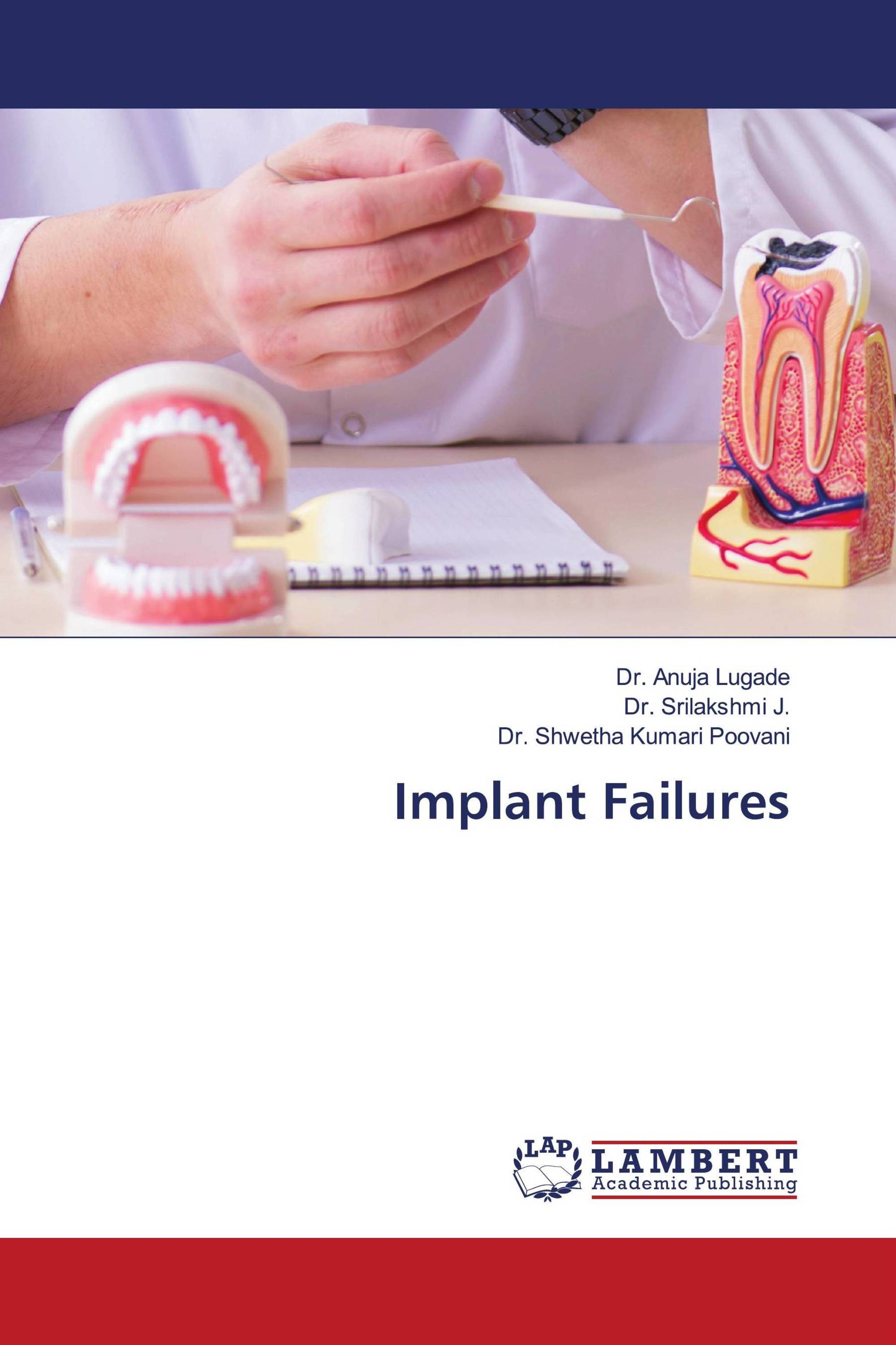 Implant Failures