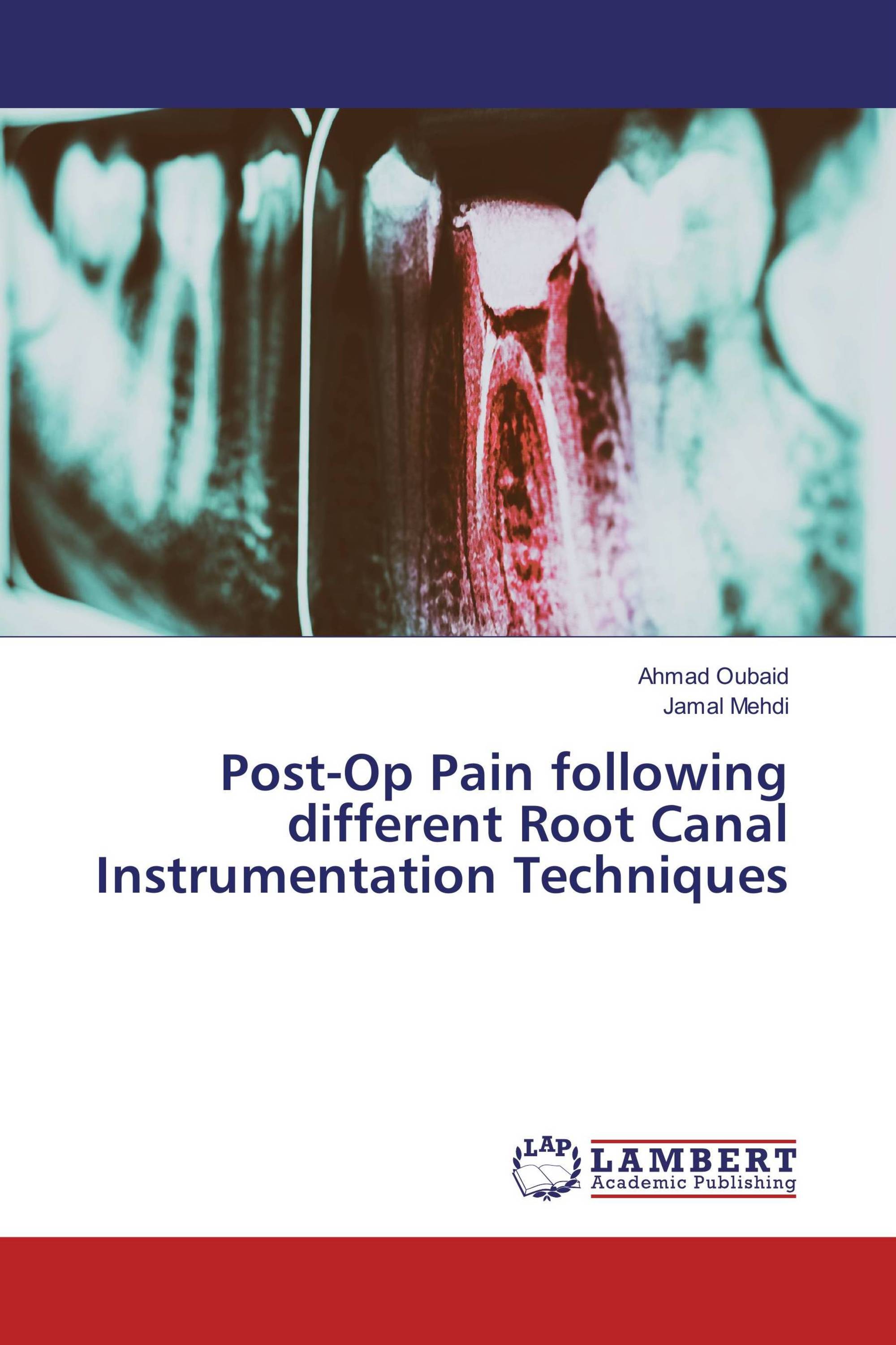PostOp Pain following different Root Canal Instrumentation Techniques