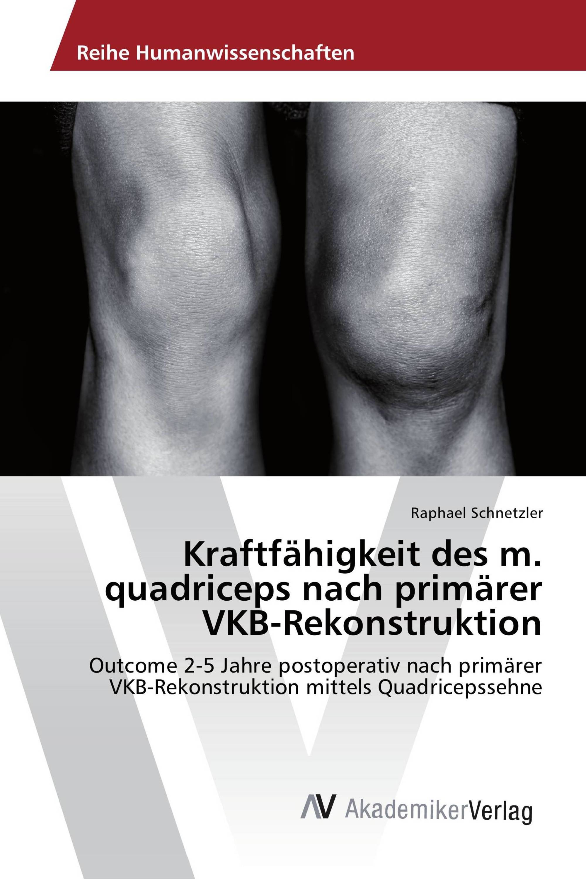 Kraftfähigkeit des m. quadriceps nach primärer VKB-Rekonstruktion