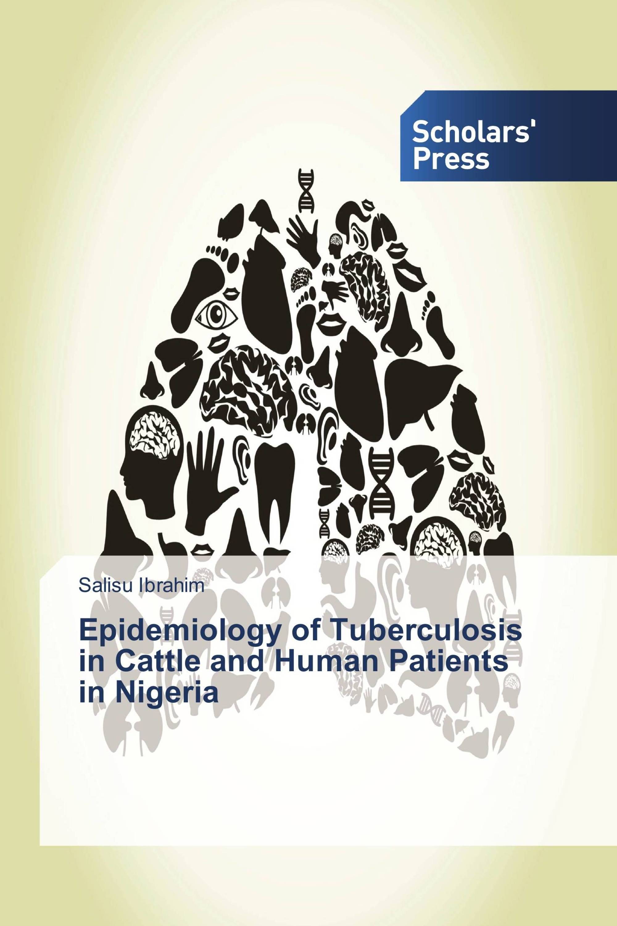 Epidemiology of Tuberculosis in Cattle and Human Patients in Nigeria