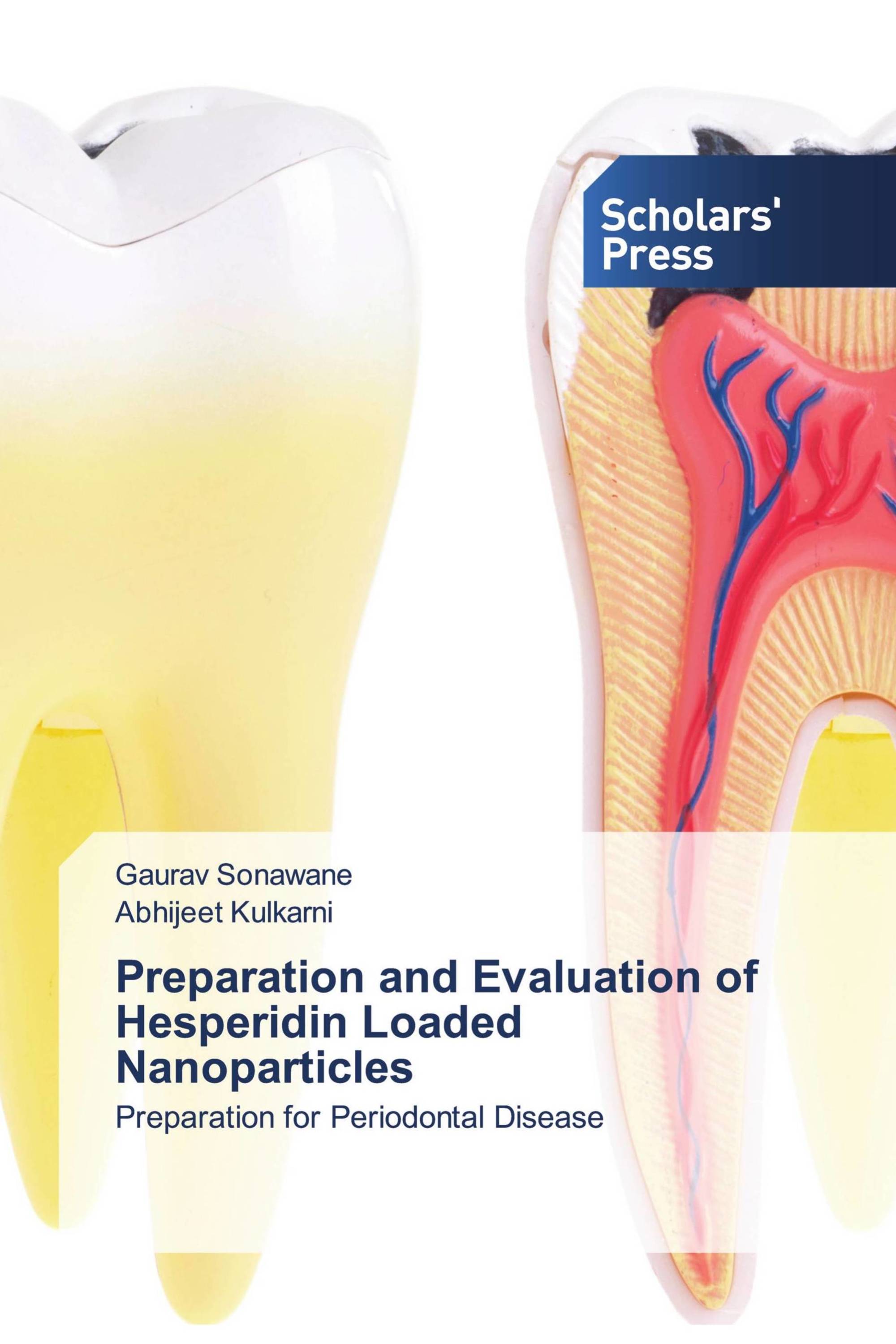 Preparation and Evaluation of Hesperidin Loaded Nanoparticles