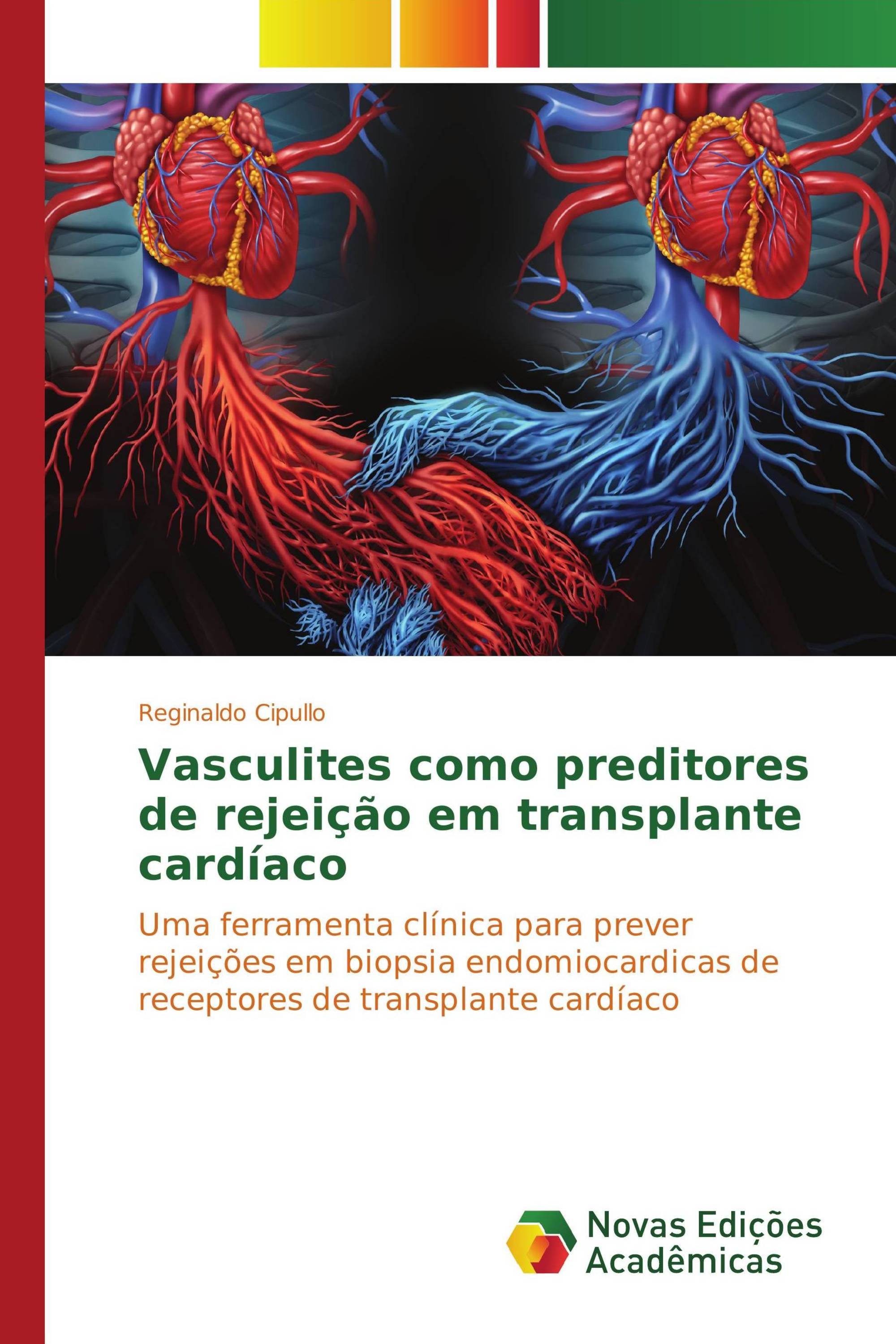 Vasculites como preditores de rejeição em transplante cardíaco