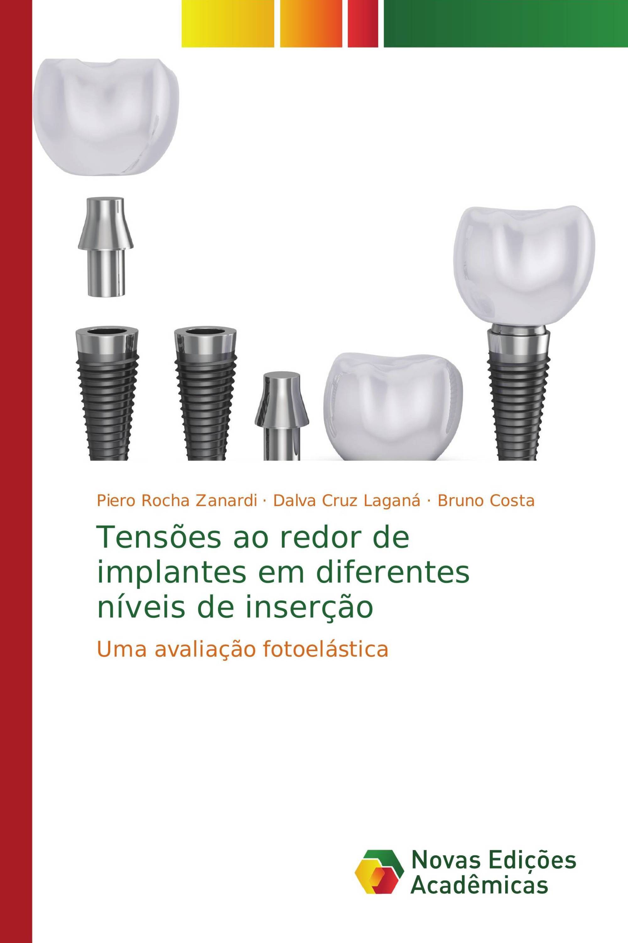 Tensões ao redor de implantes em diferentes níveis de inserção