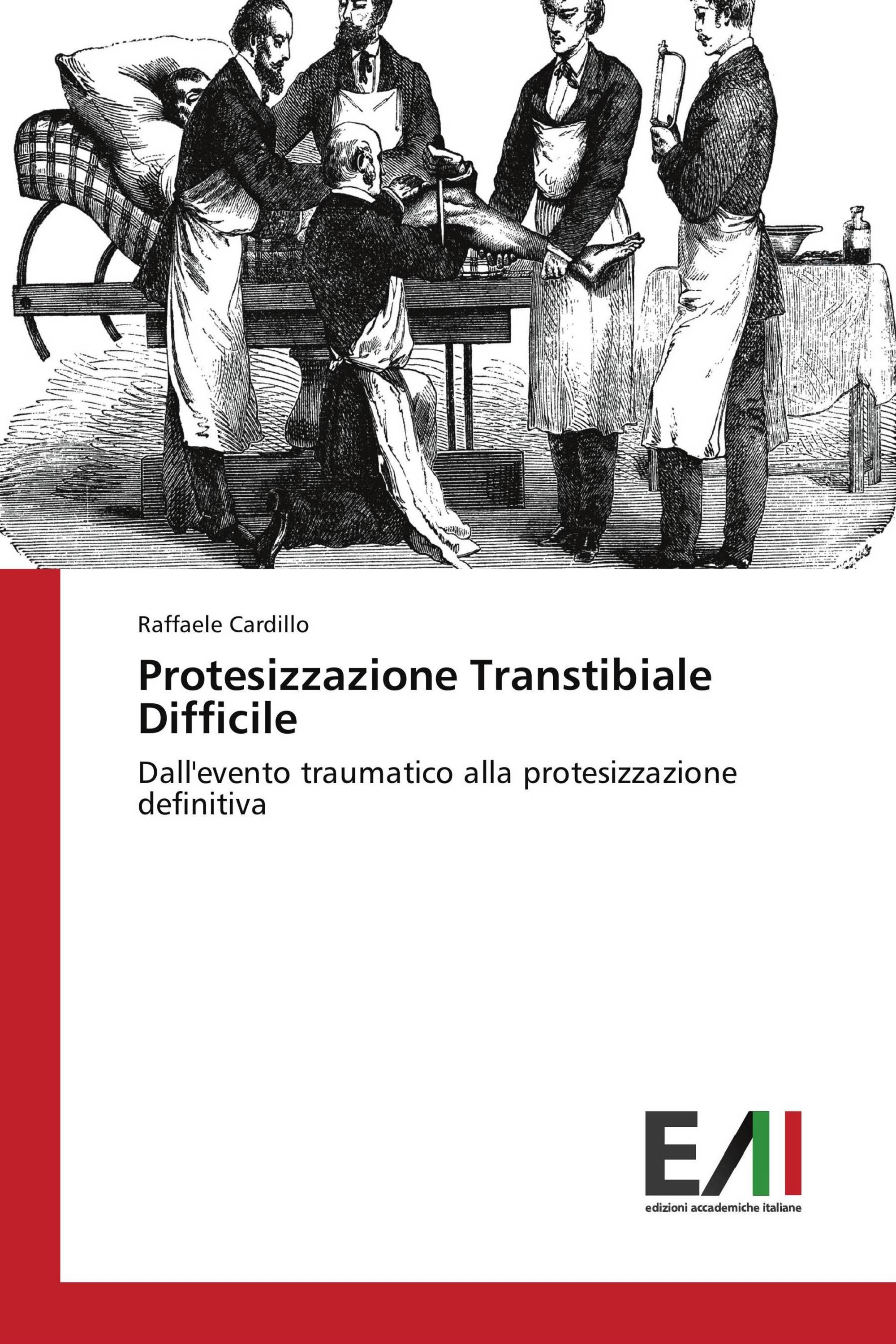 Protesizzazione Transtibiale Difficile