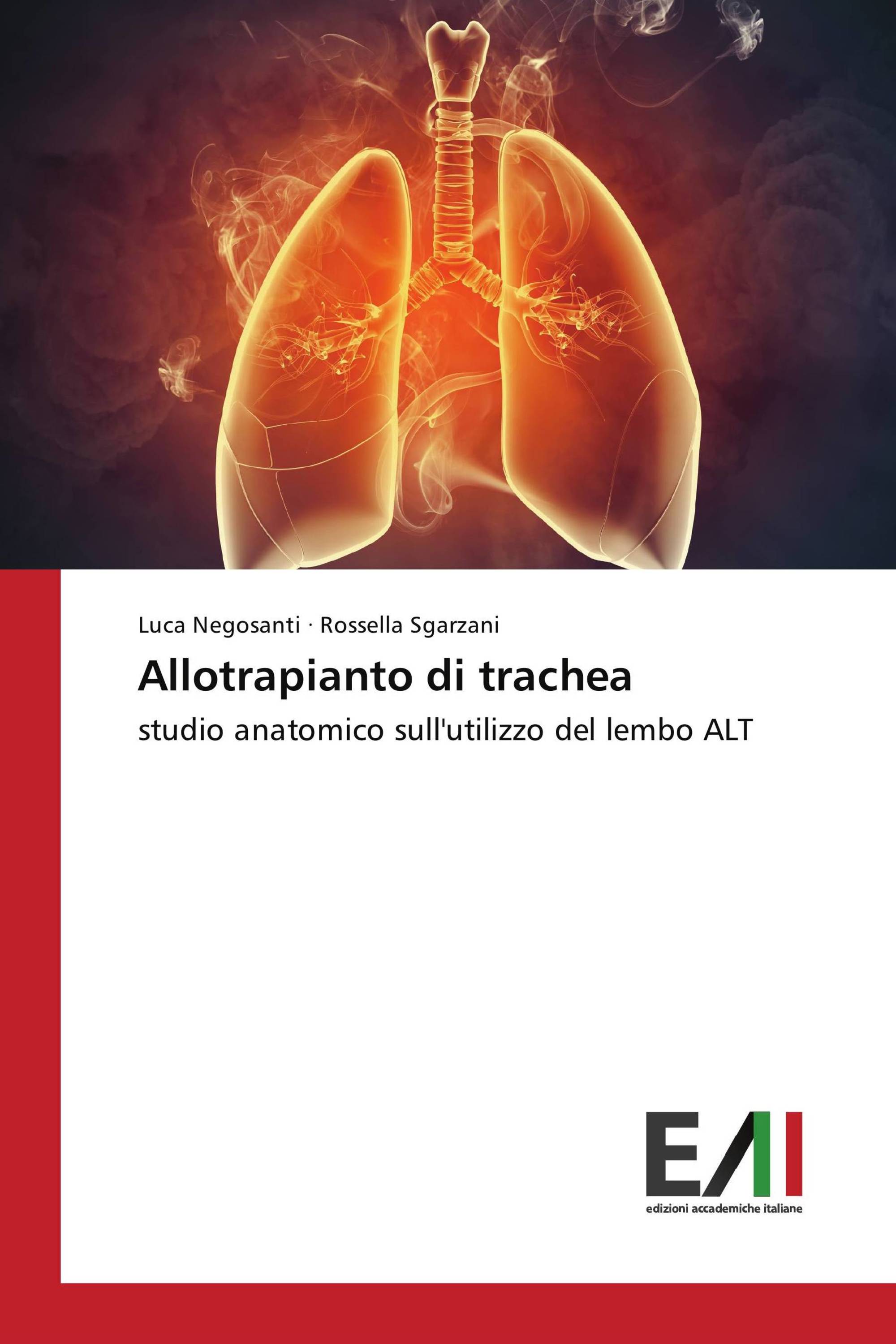 Allotrapianto di trachea