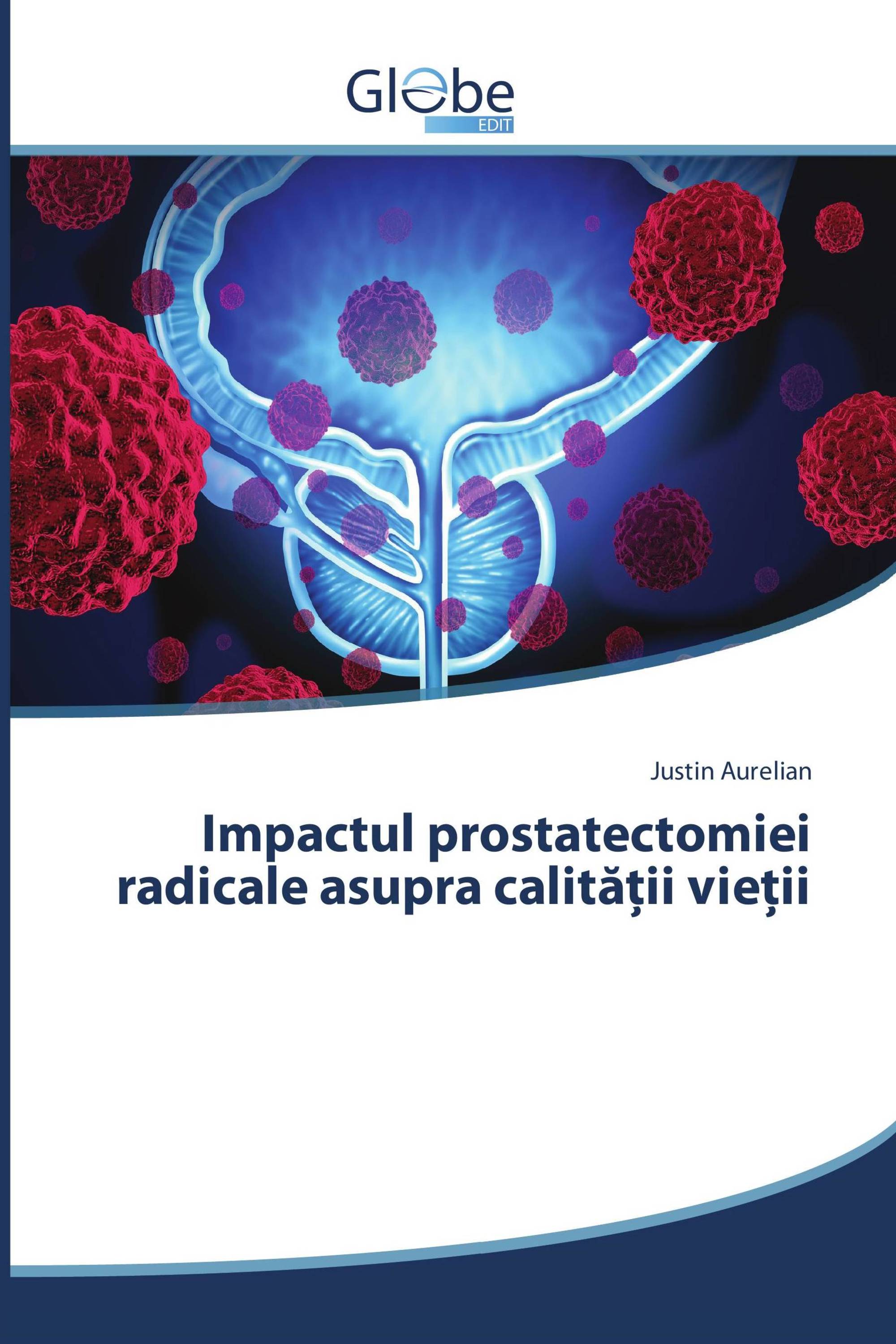 Impactul prostatectomiei radicale asupra calității vieții