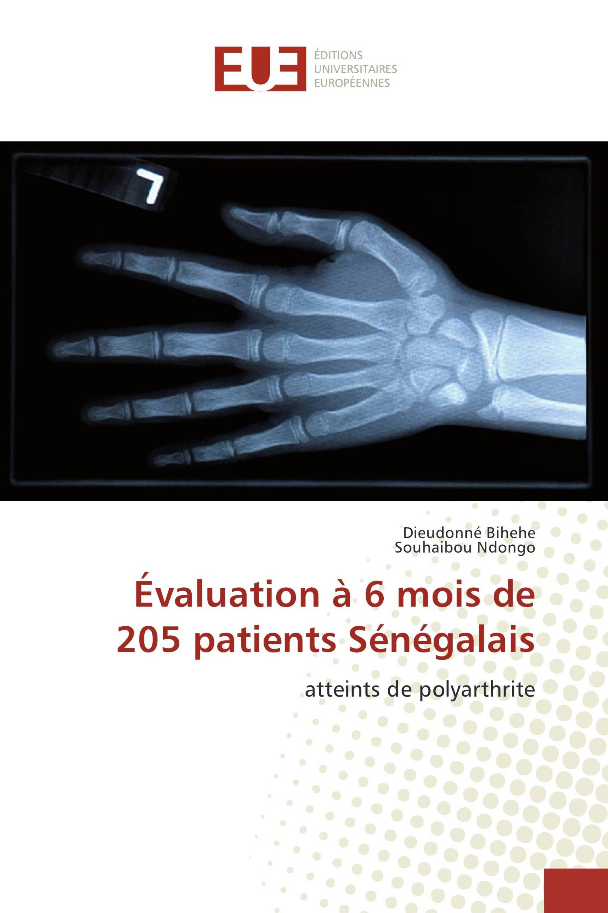 Évaluation à 6 mois de 205 patients Sénégalais