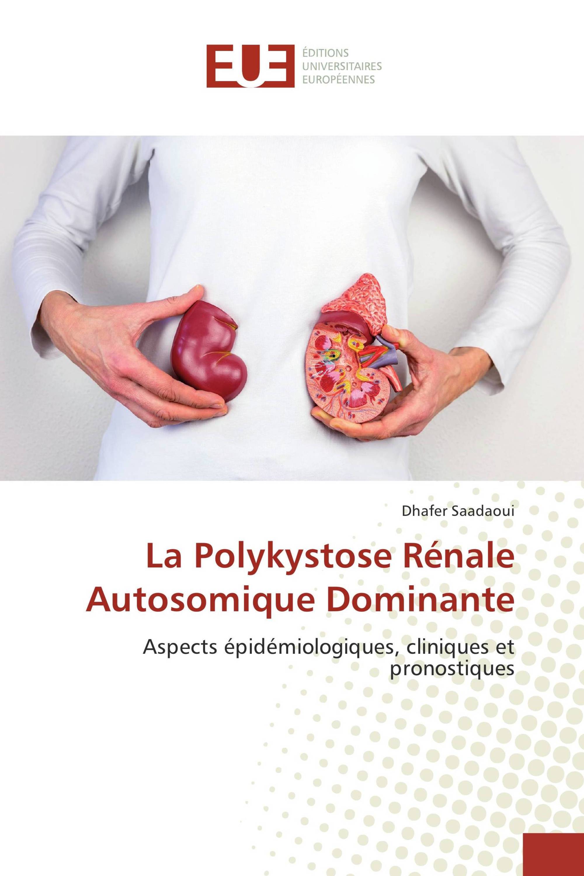 La Polykystose Rénale Autosomique Dominante