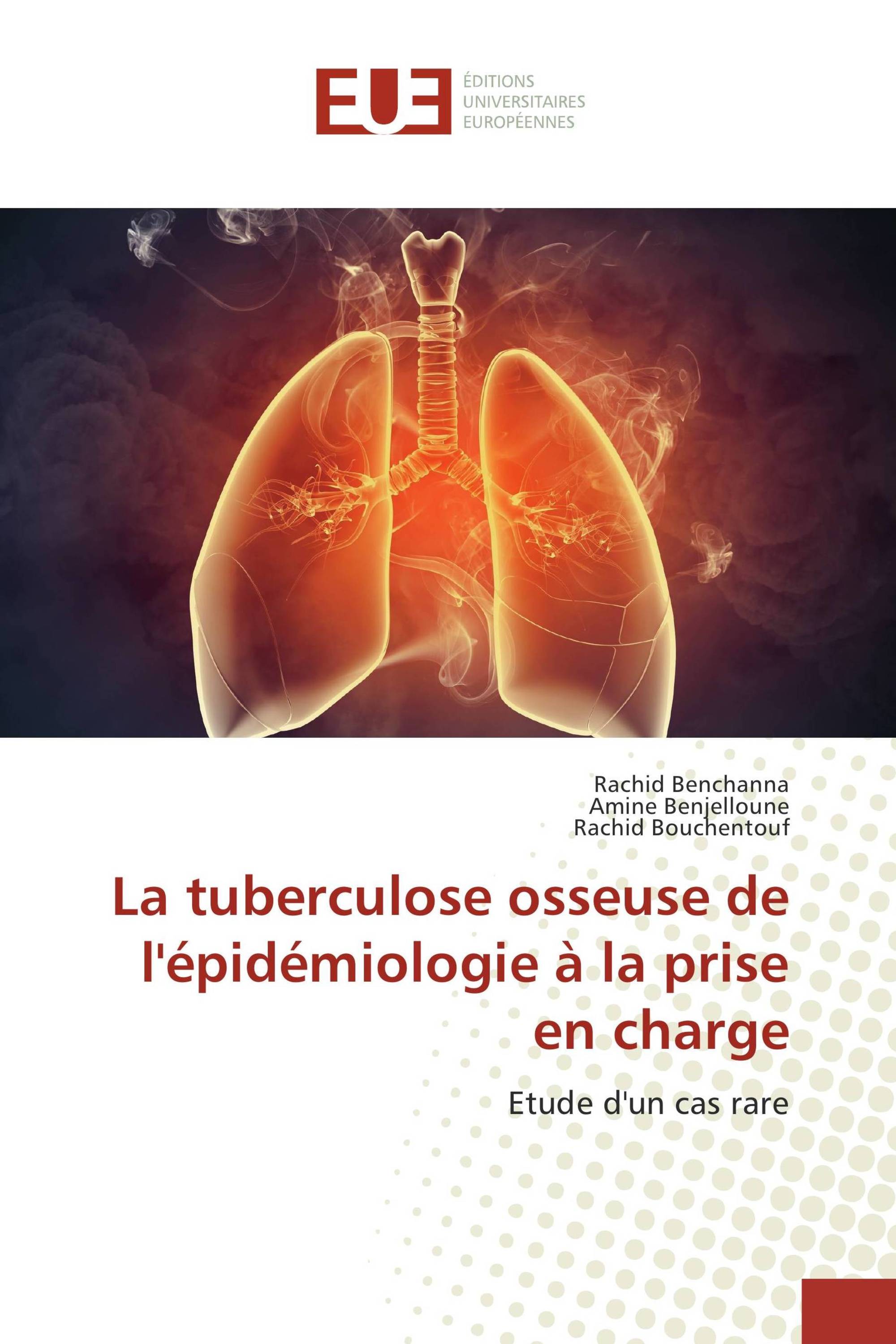 La tuberculose osseuse de l'épidémiologie à la prise en charge