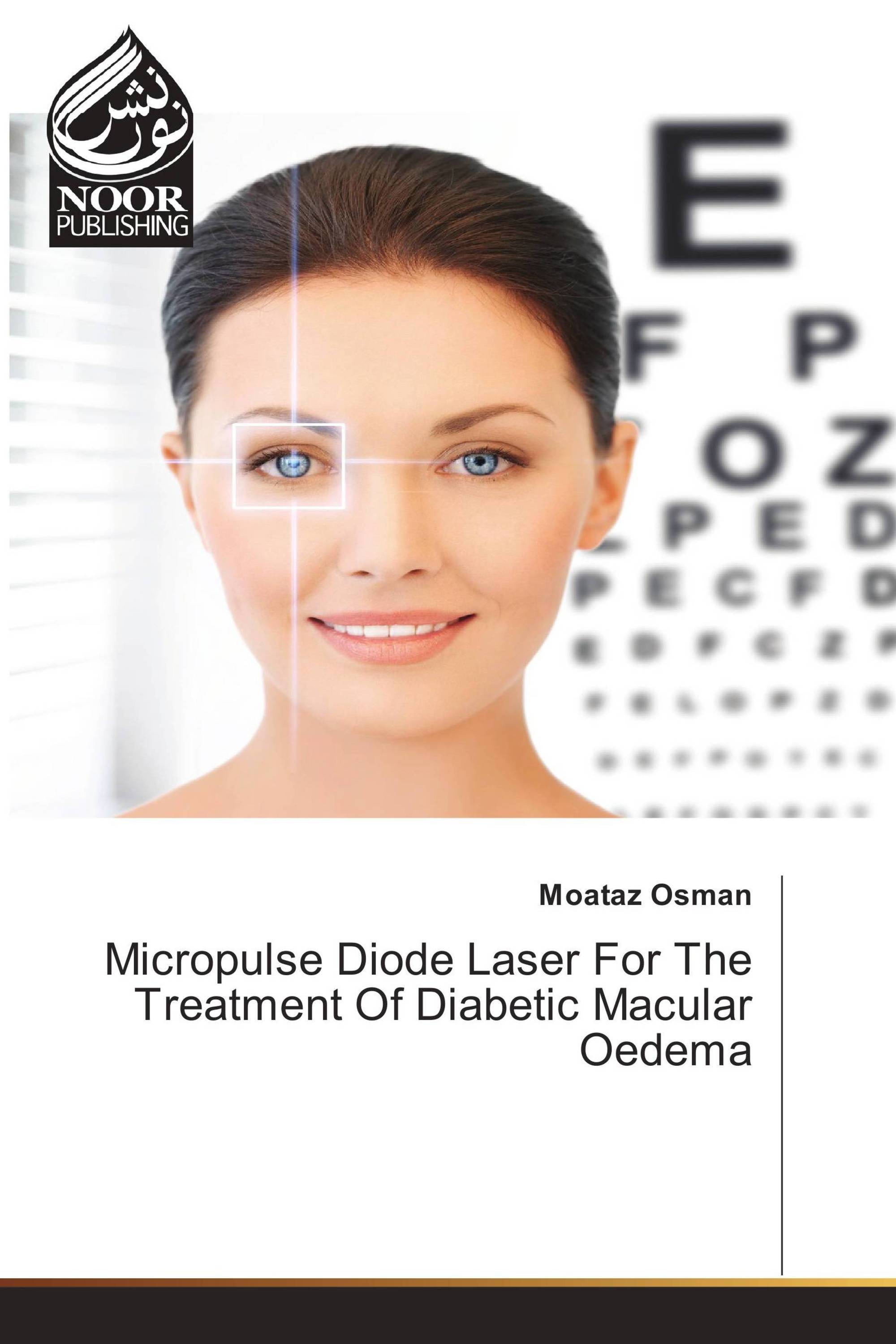 Micropulse Diode Laser For The Treatment Of Diabetic Macular Oedema
