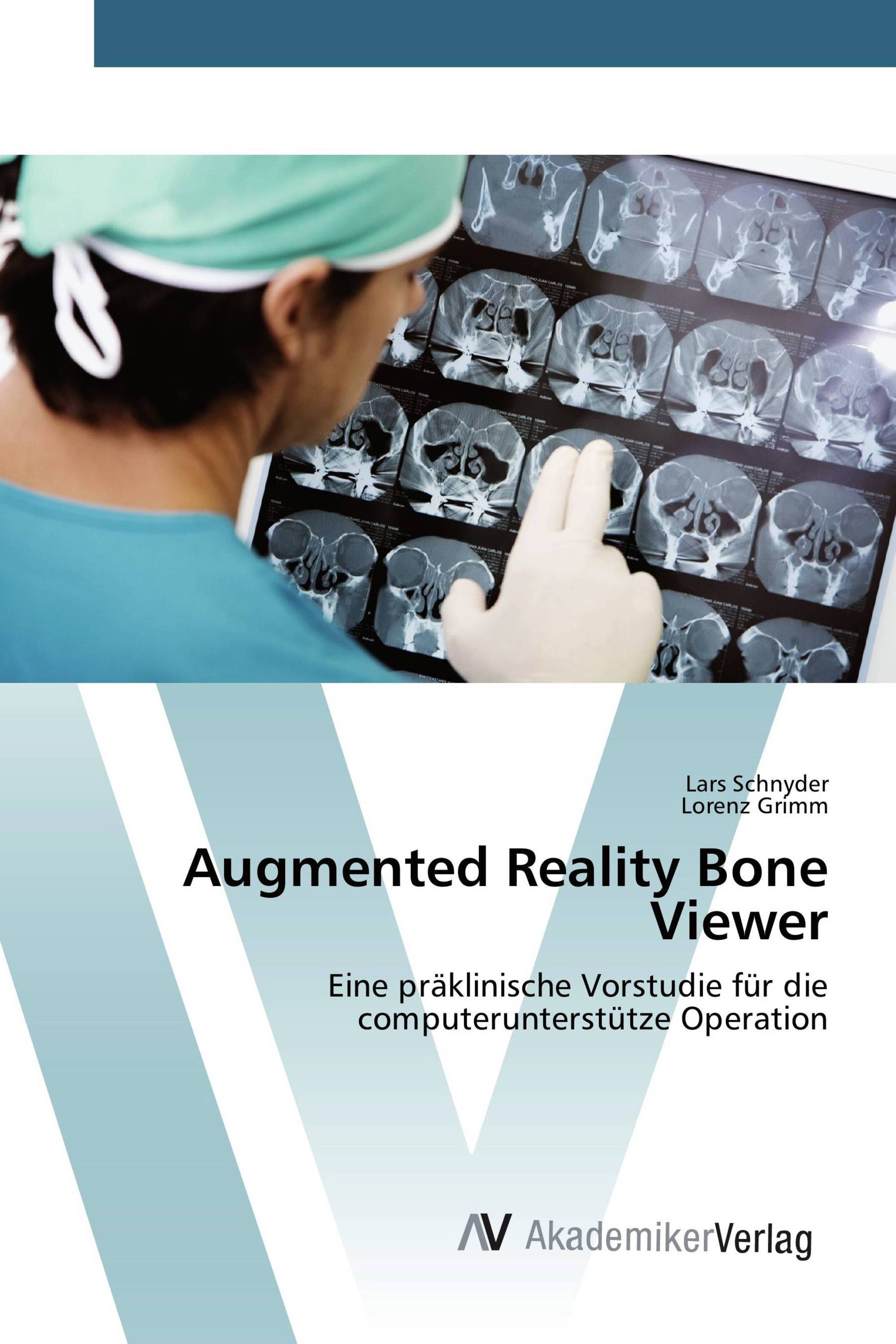 Augmented Reality Bone Viewer