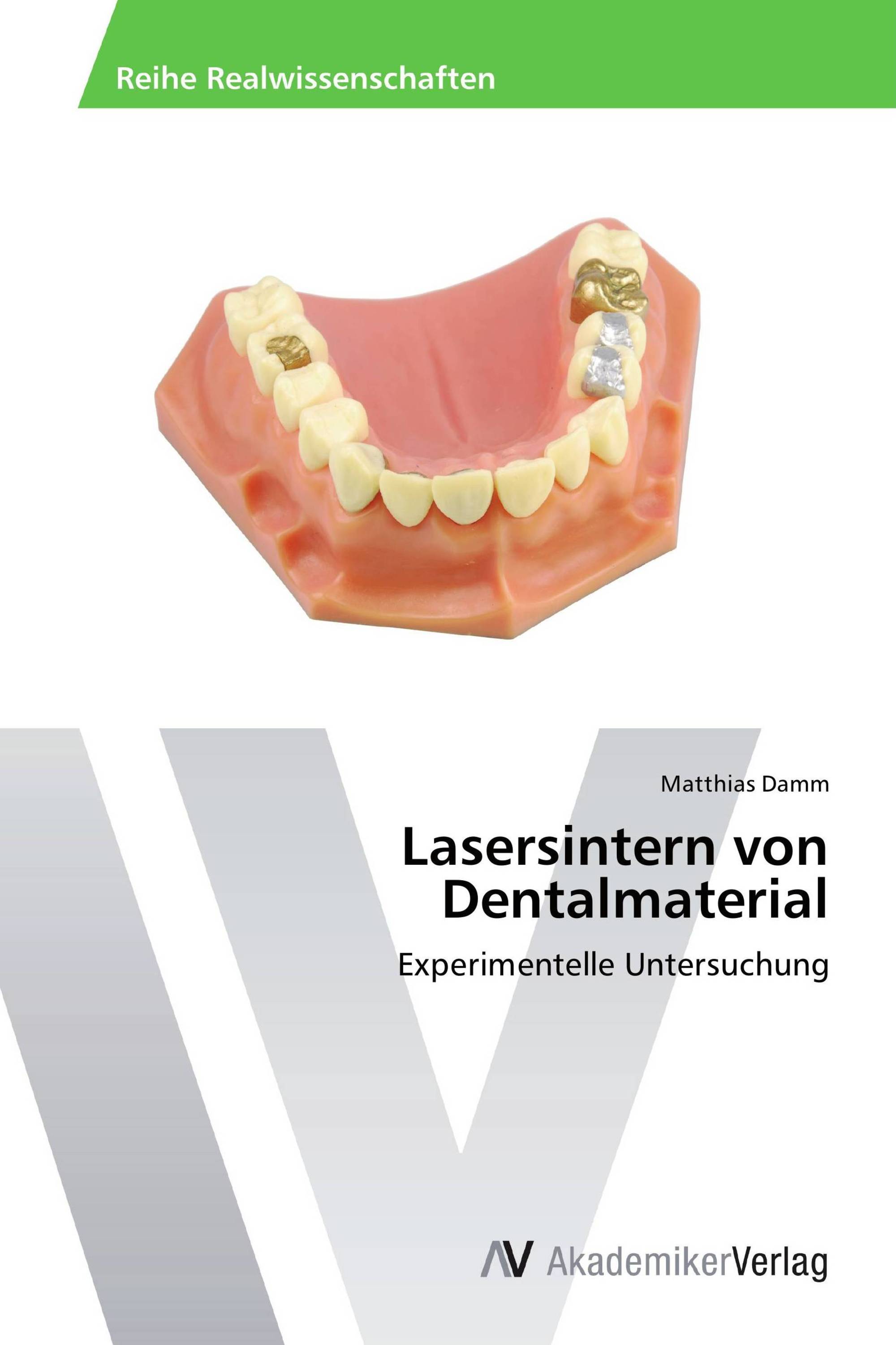 Lasersintern von Dentalmaterial