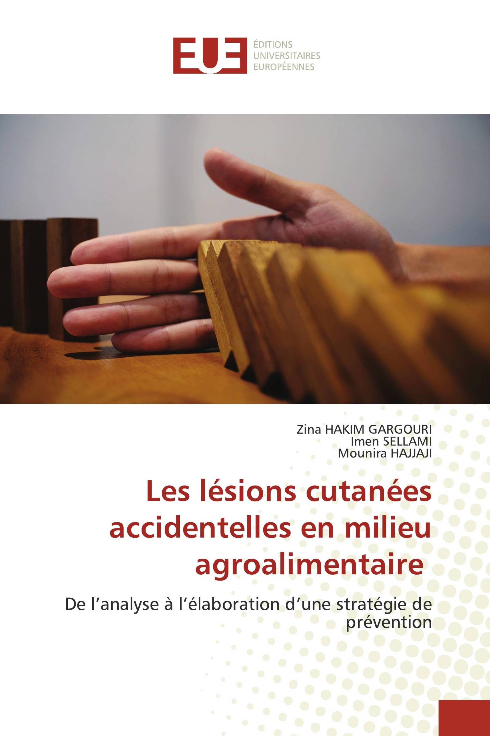 Les lésions cutanées accidentelles en milieu agroalimentaire