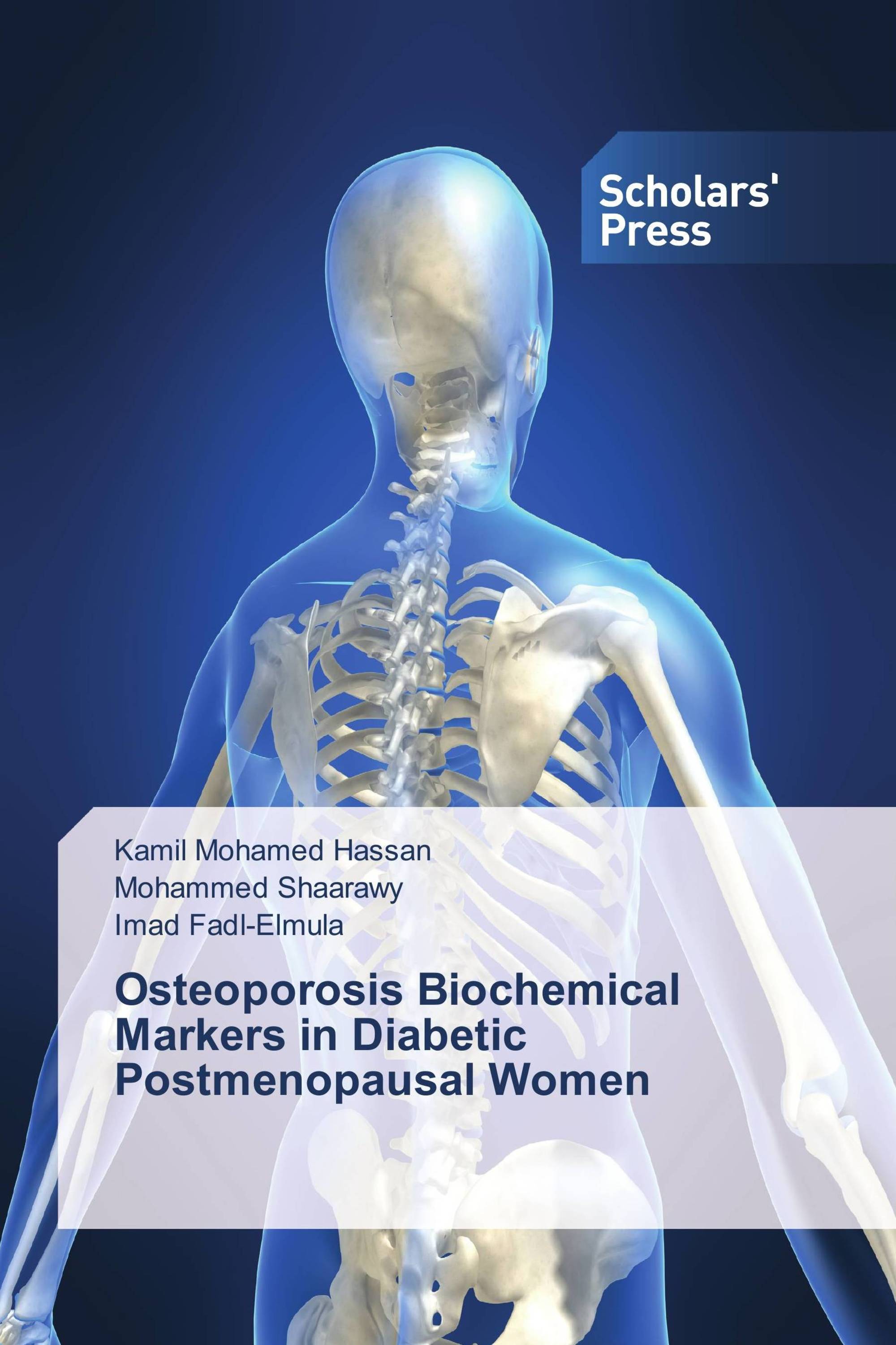 Osteoporosis Biochemical Markers in Diabetic Postmenopausal Women