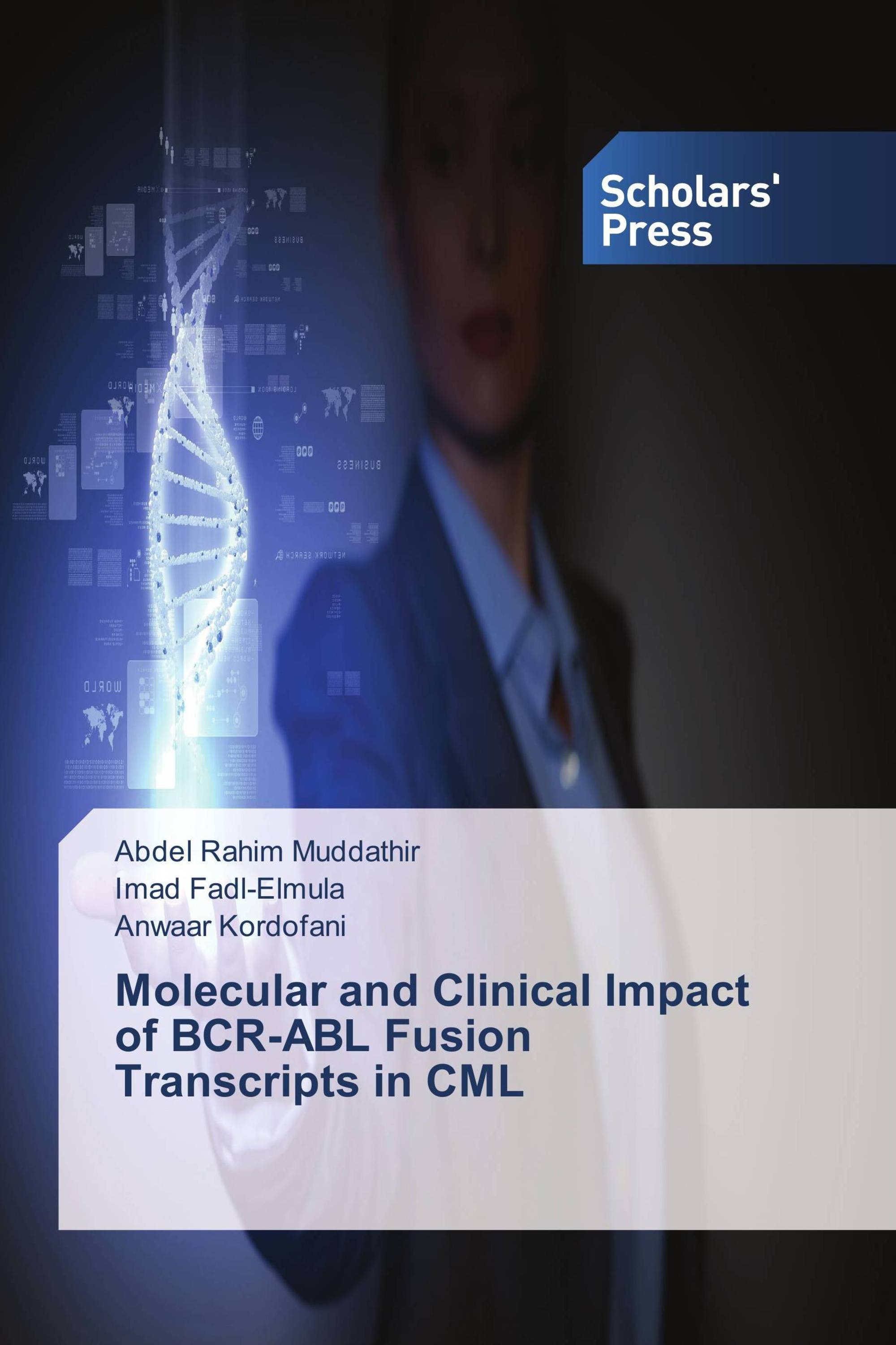 Molecular and Clinical Impact of BCR-ABL Fusion Transcripts in CML