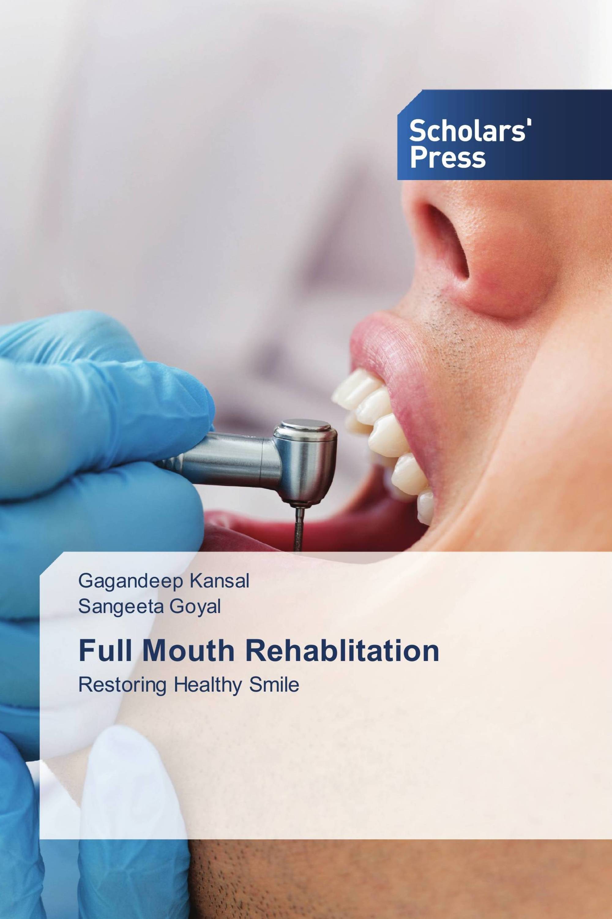 Full Mouth Rehablitation