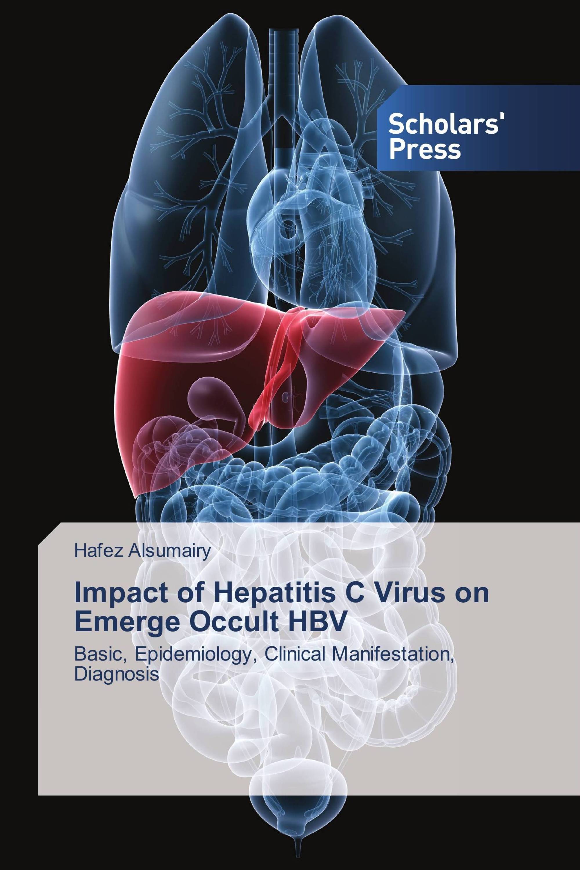 Impact of Hepatitis C Virus on Emerge Occult HBV