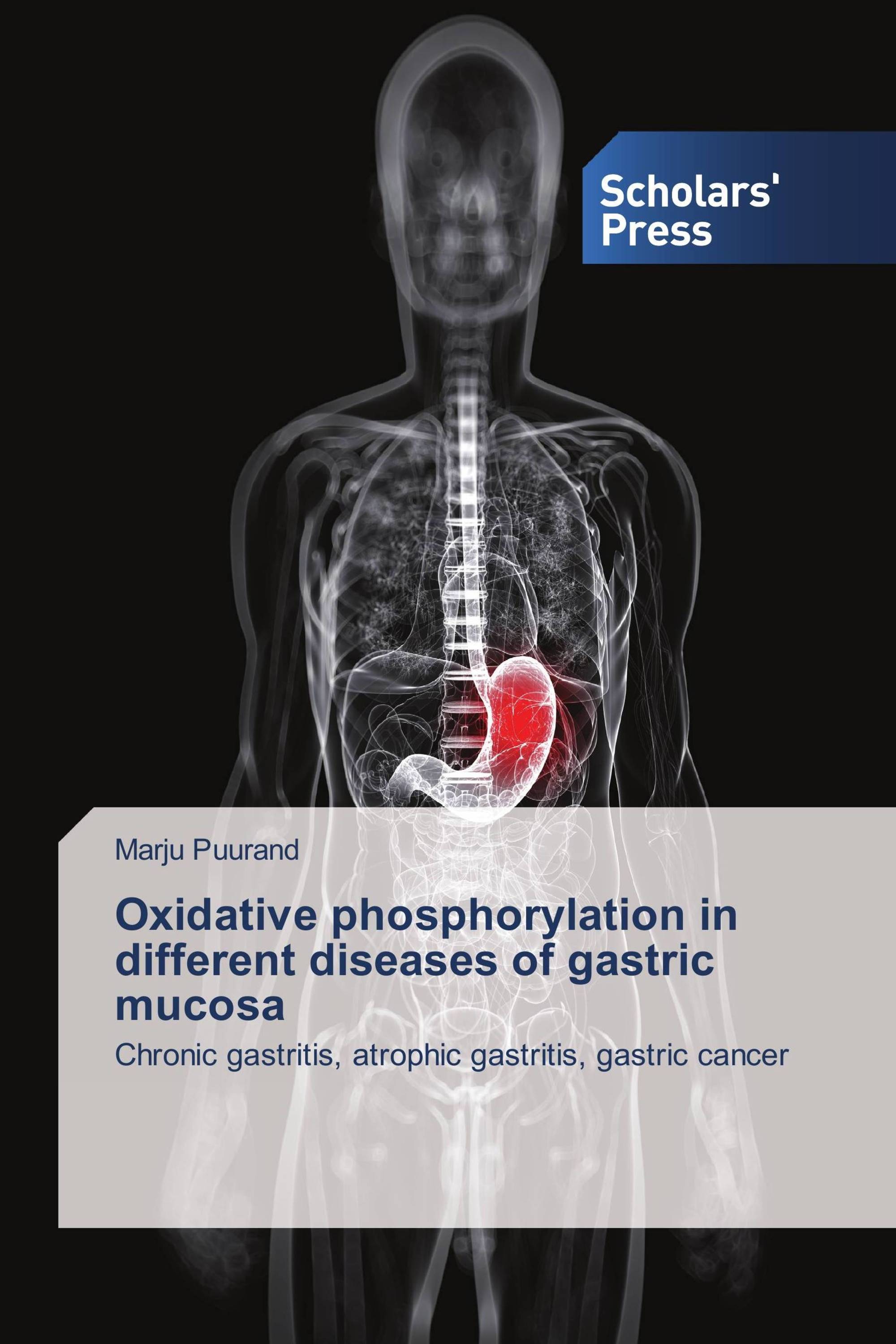 Oxidative phosphorylation in different diseases of gastric mucosa