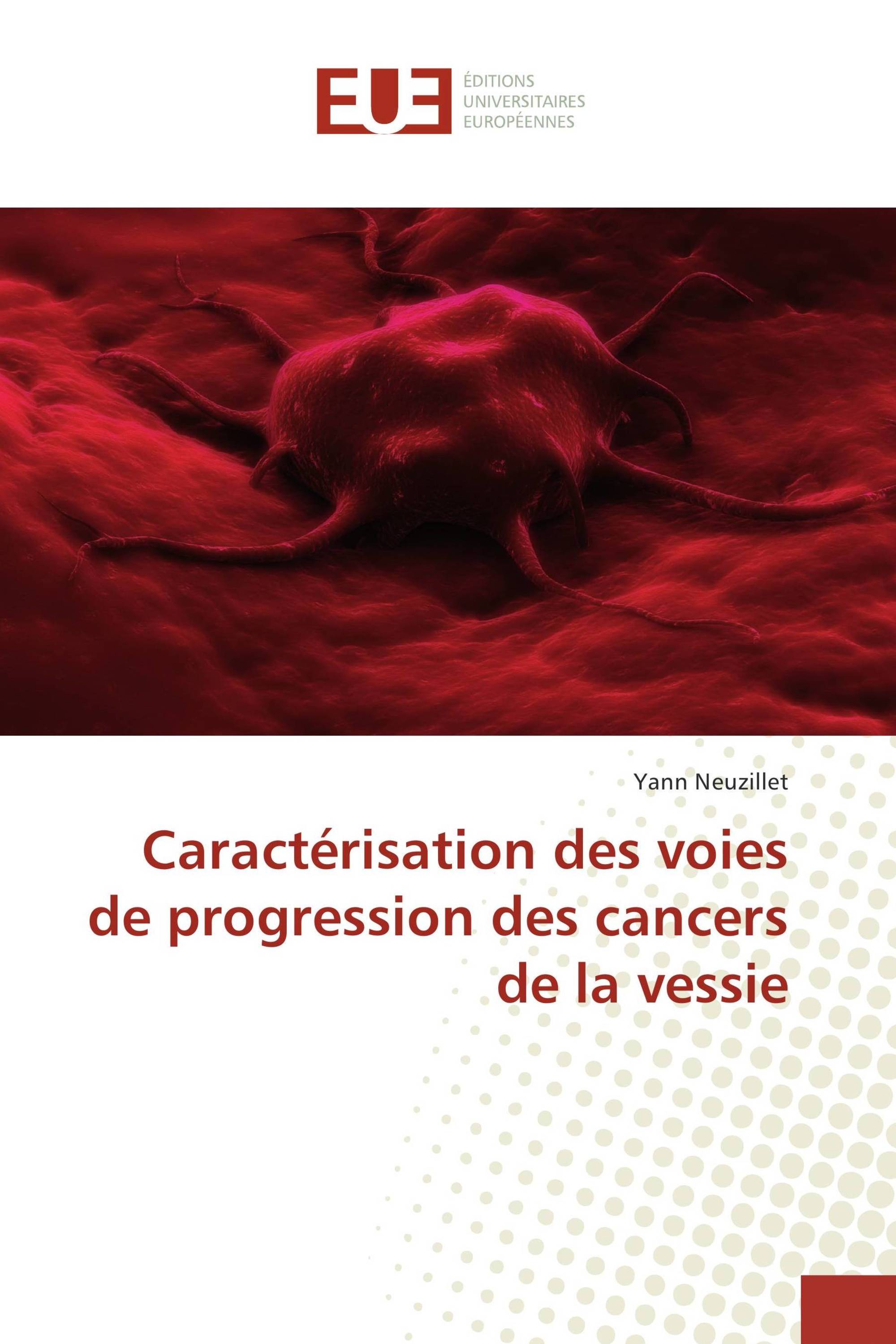 Caractérisation des voies de progression des cancers de la vessie