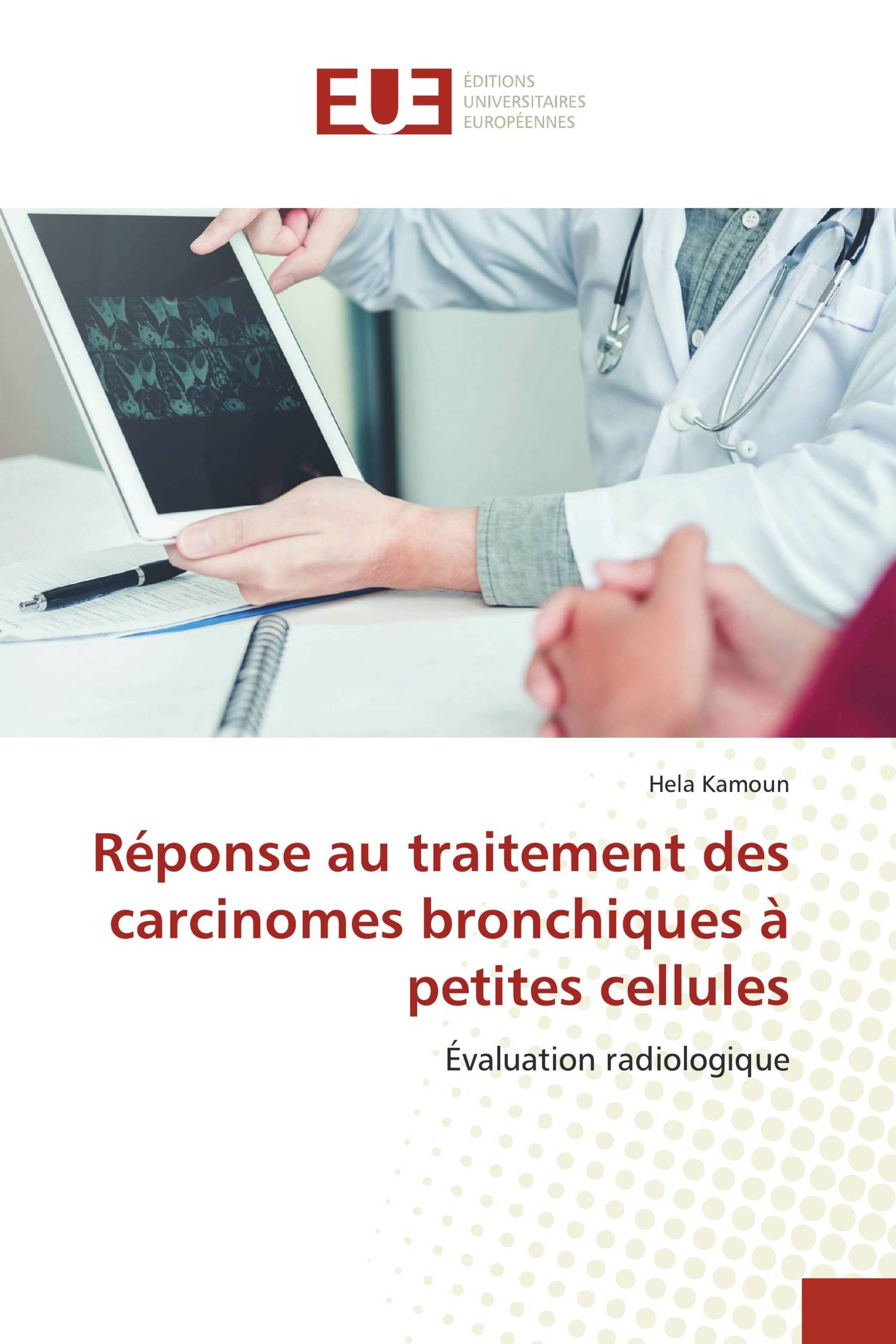 Réponse au traitement des carcinomes bronchiques à petites cellules