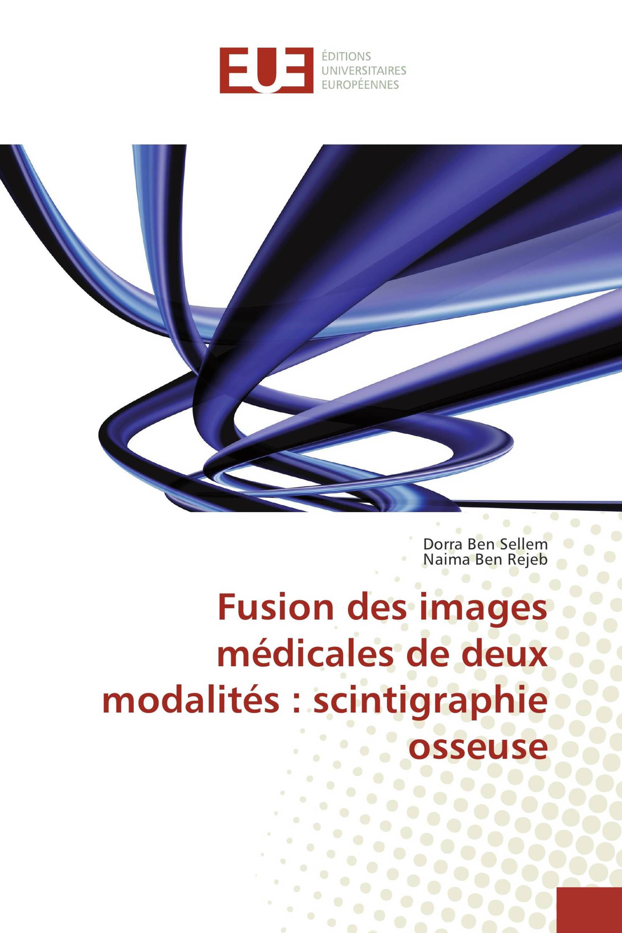 Fusion des images médicales de deux modalités : scintigraphie osseuse