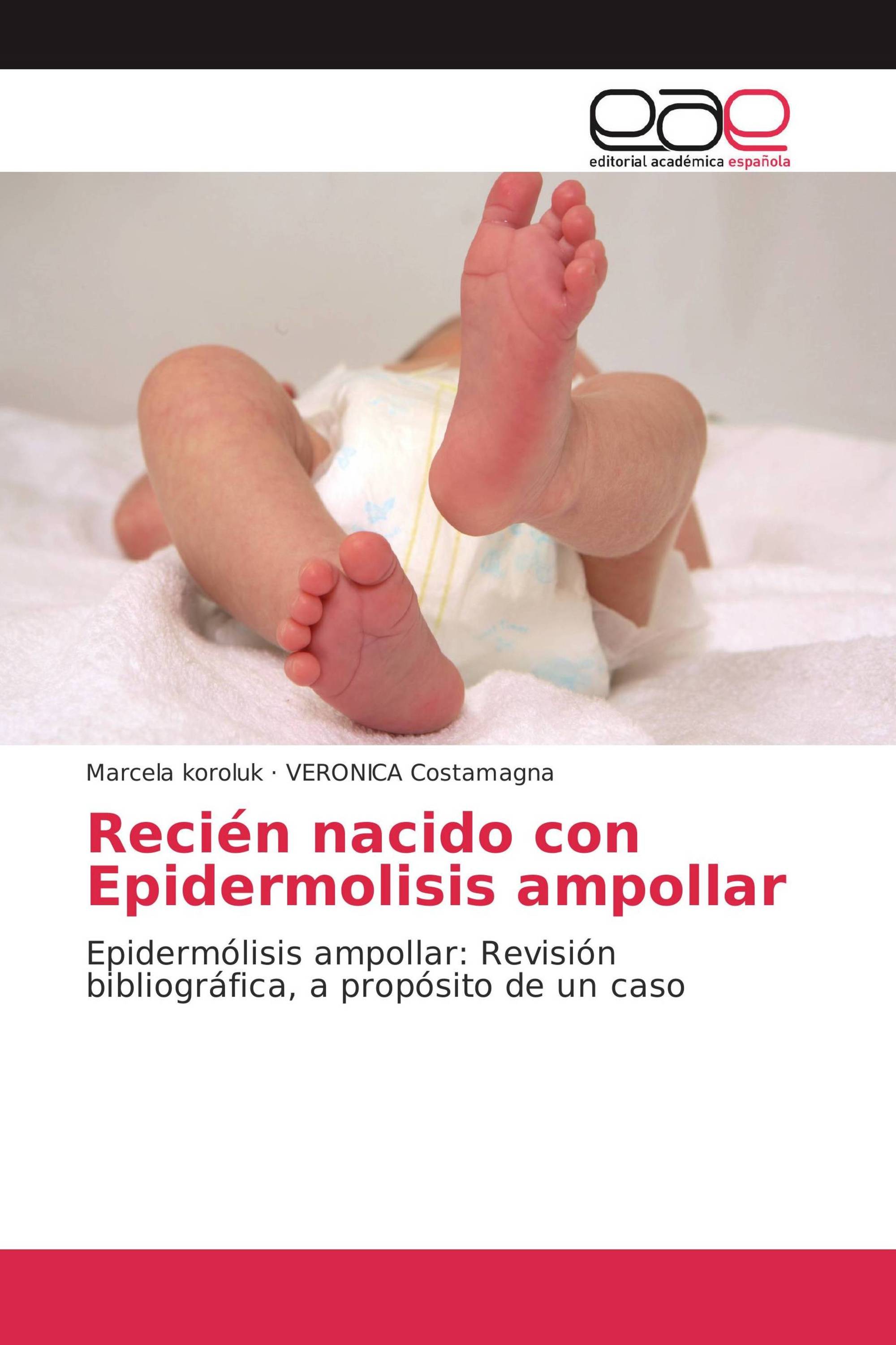 Recién nacido con Epidermolisis ampollar