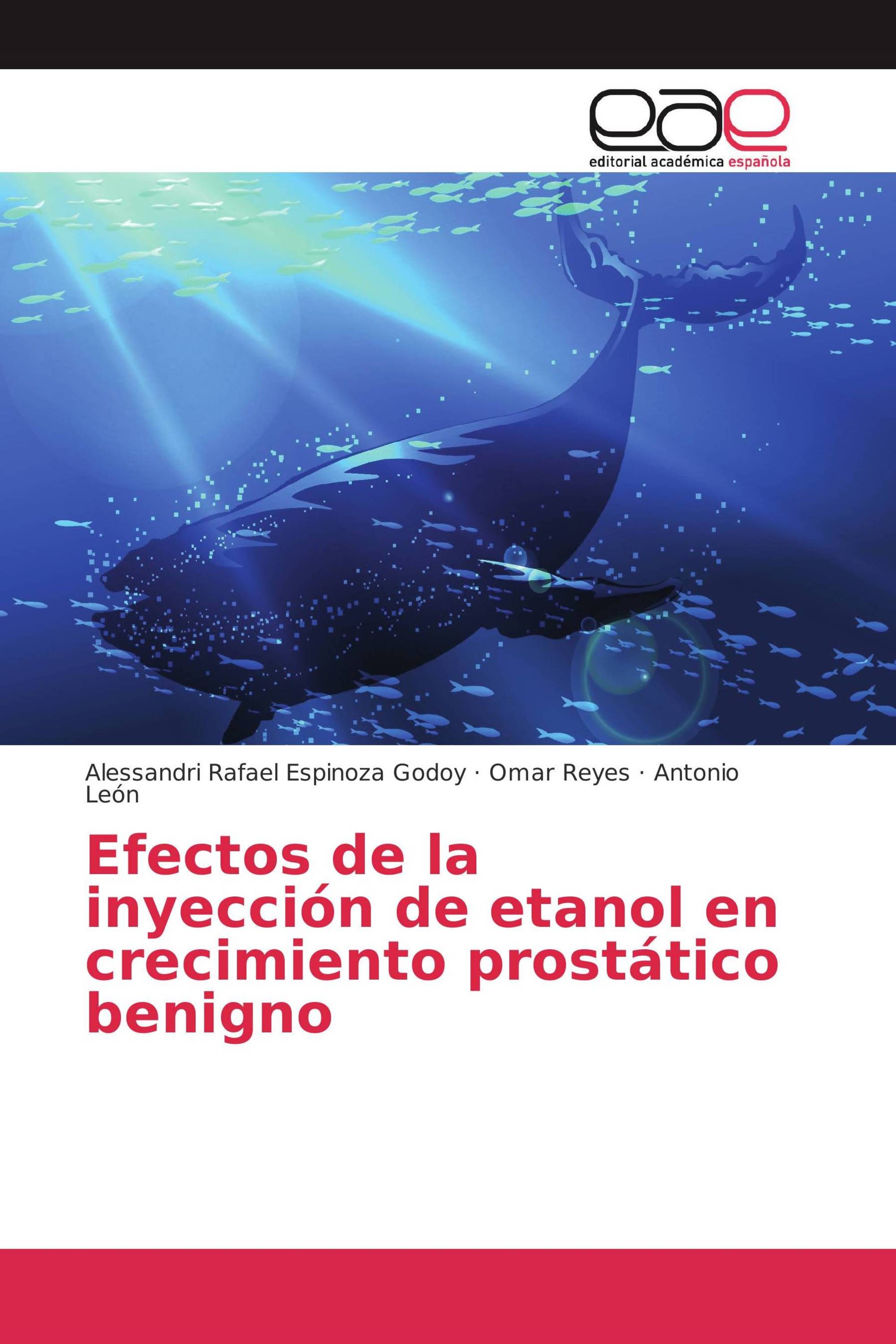 Efectos de la inyección de etanol en crecimiento prostático benigno