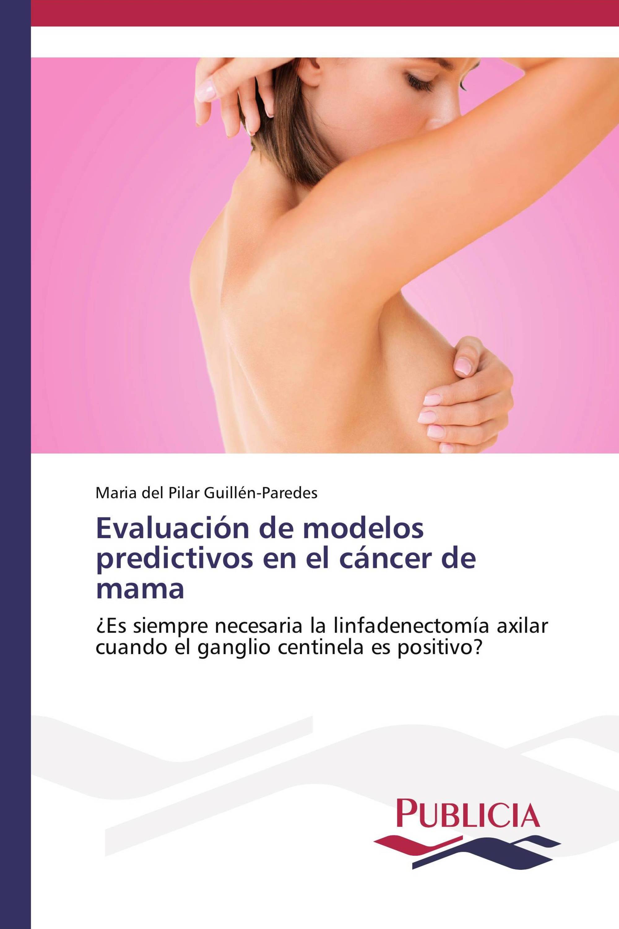 Evaluación de modelos predictivos en el cáncer de mama