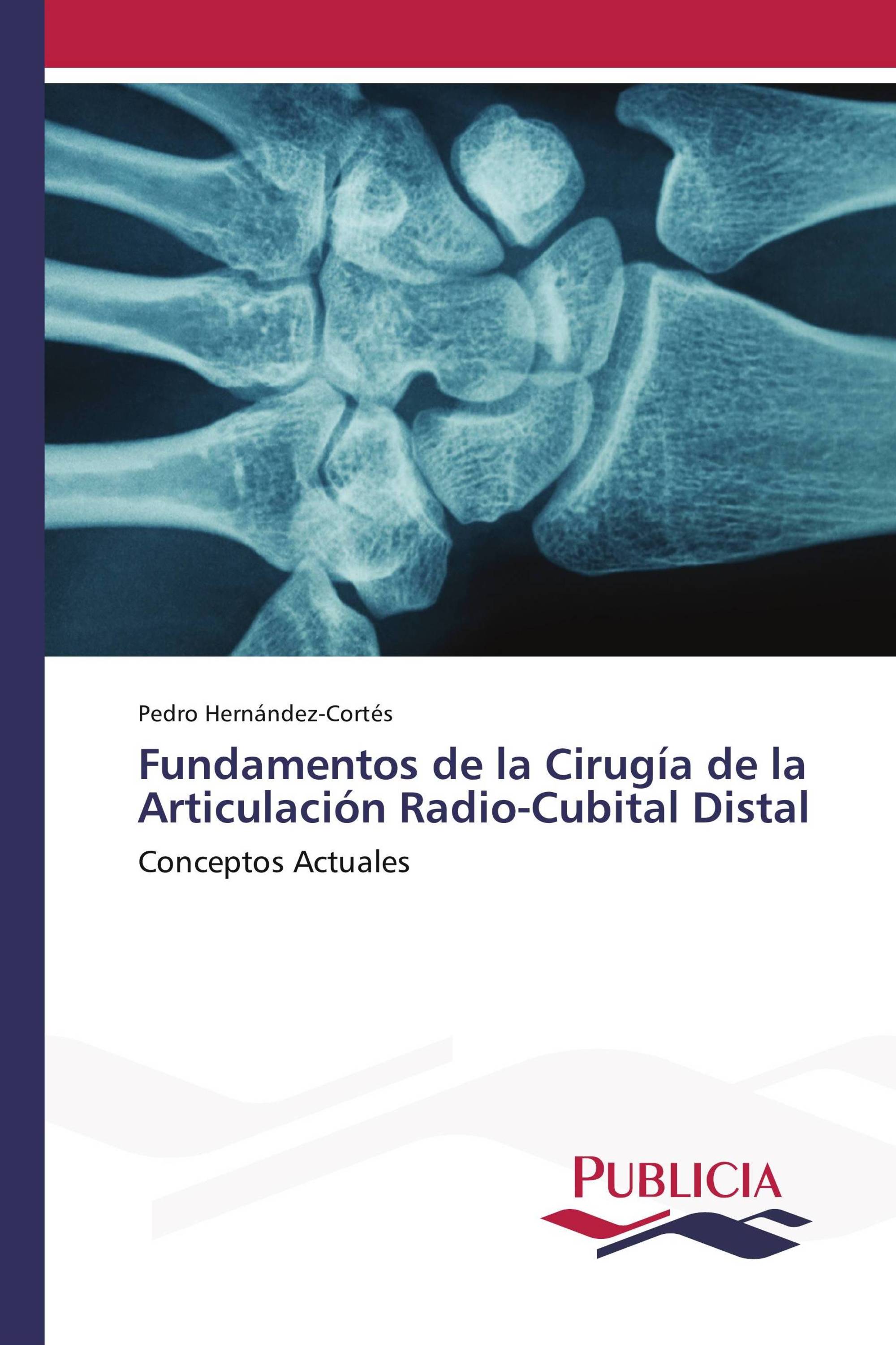 Fundamentos de la Cirugía de la Articulación Radio-Cubital Distal