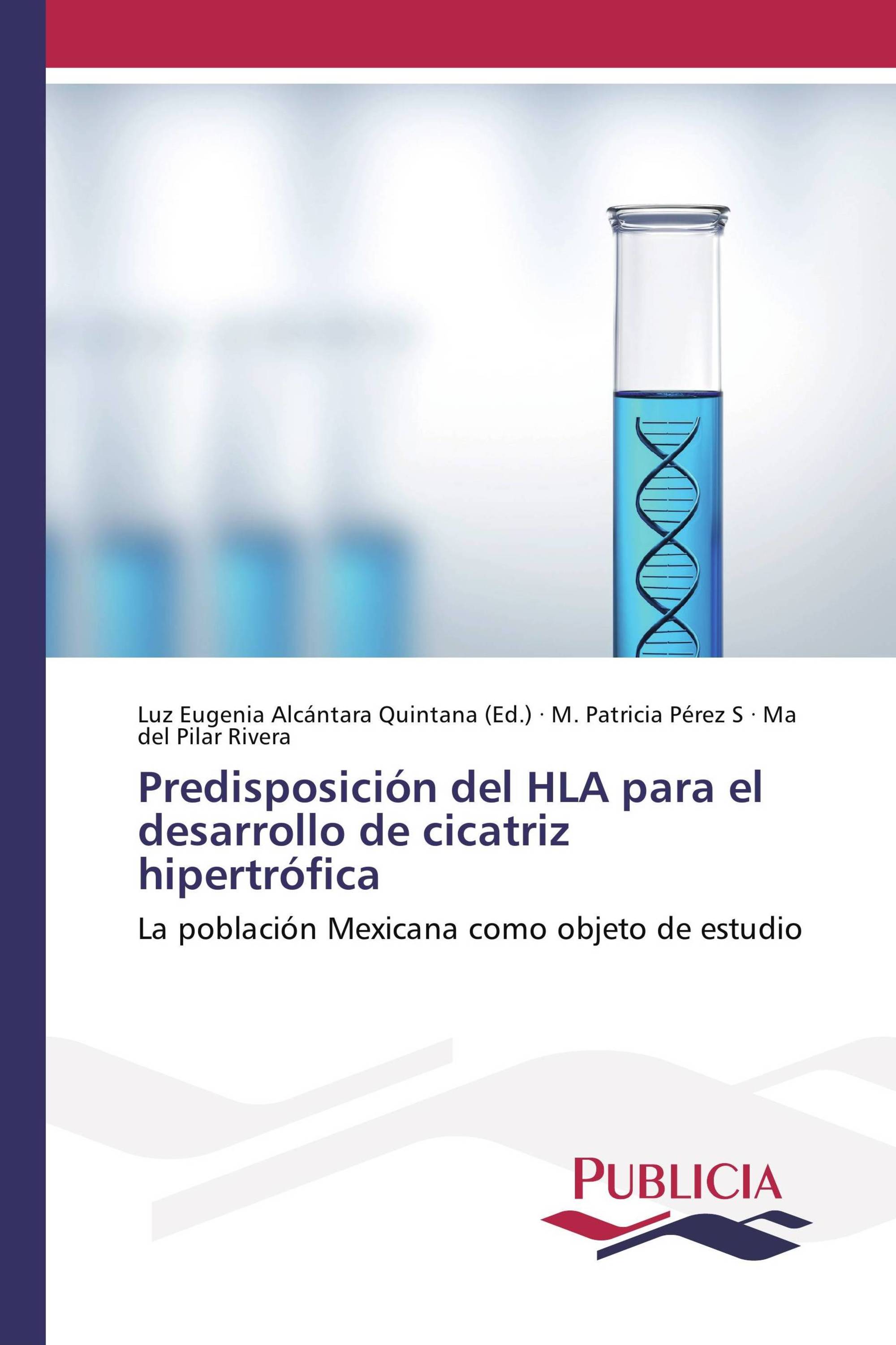 Predisposición del HLA para el desarrollo de cicatriz hipertrófica