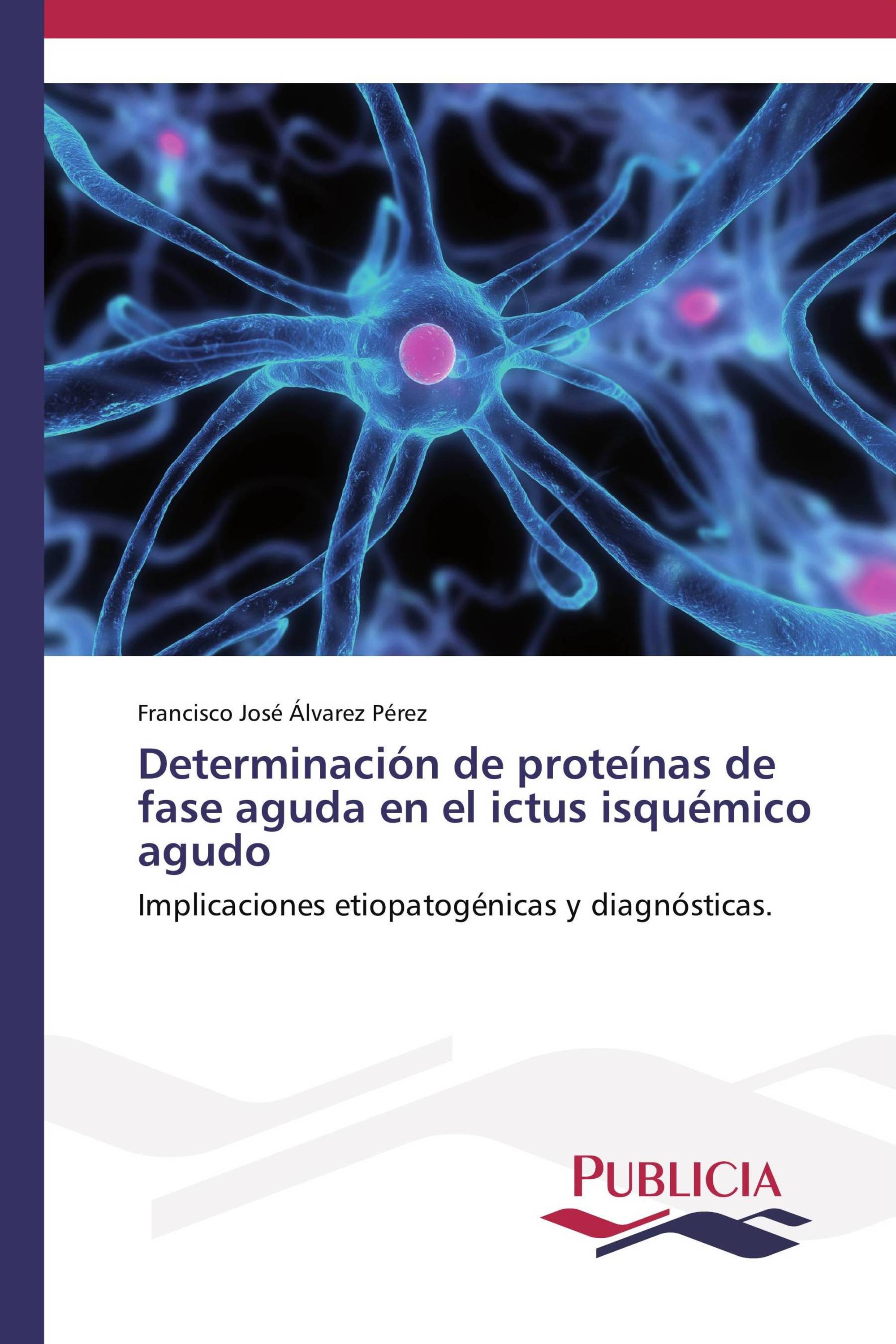 Determinación de proteínas de fase aguda en el ictus isquémico agudo