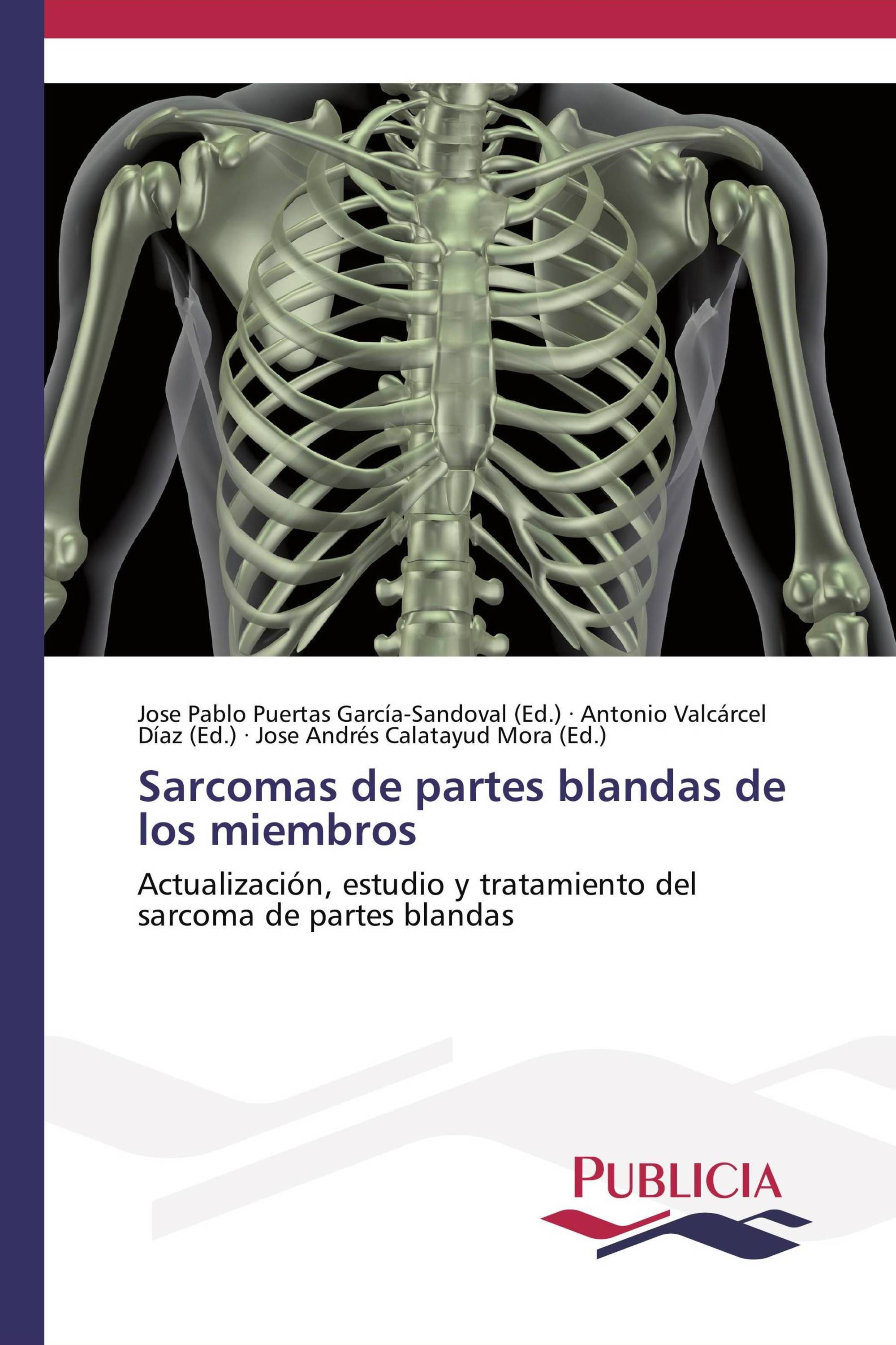 Sarcomas de partes blandas de los miembros