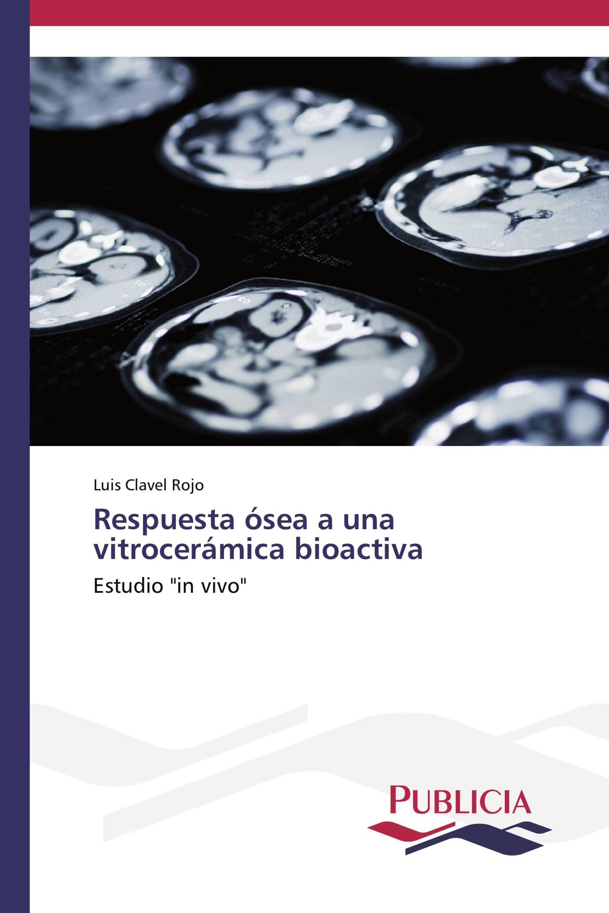 Respuesta ósea a una vitrocerámica bioactiva