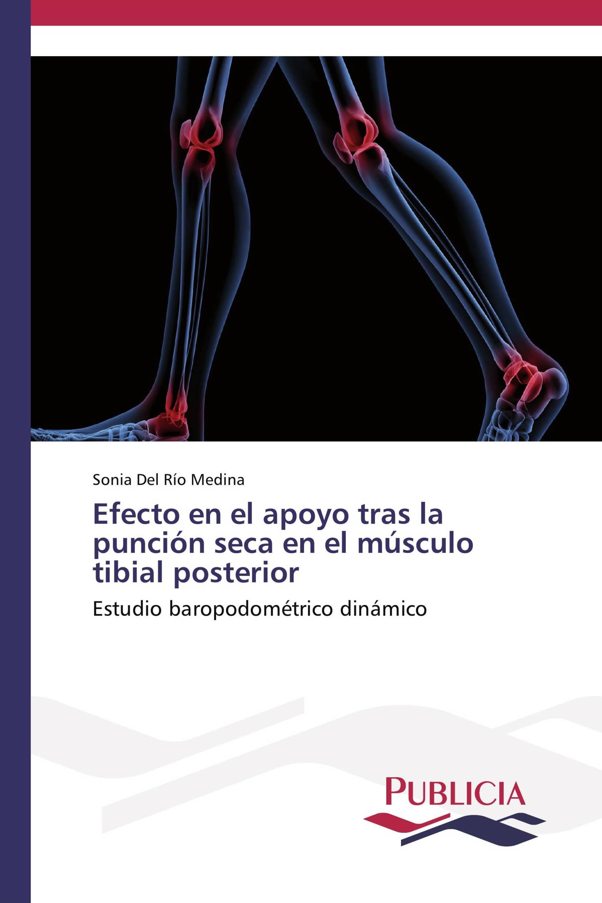 Efecto en el apoyo tras la punción seca en el músculo tibial posterior