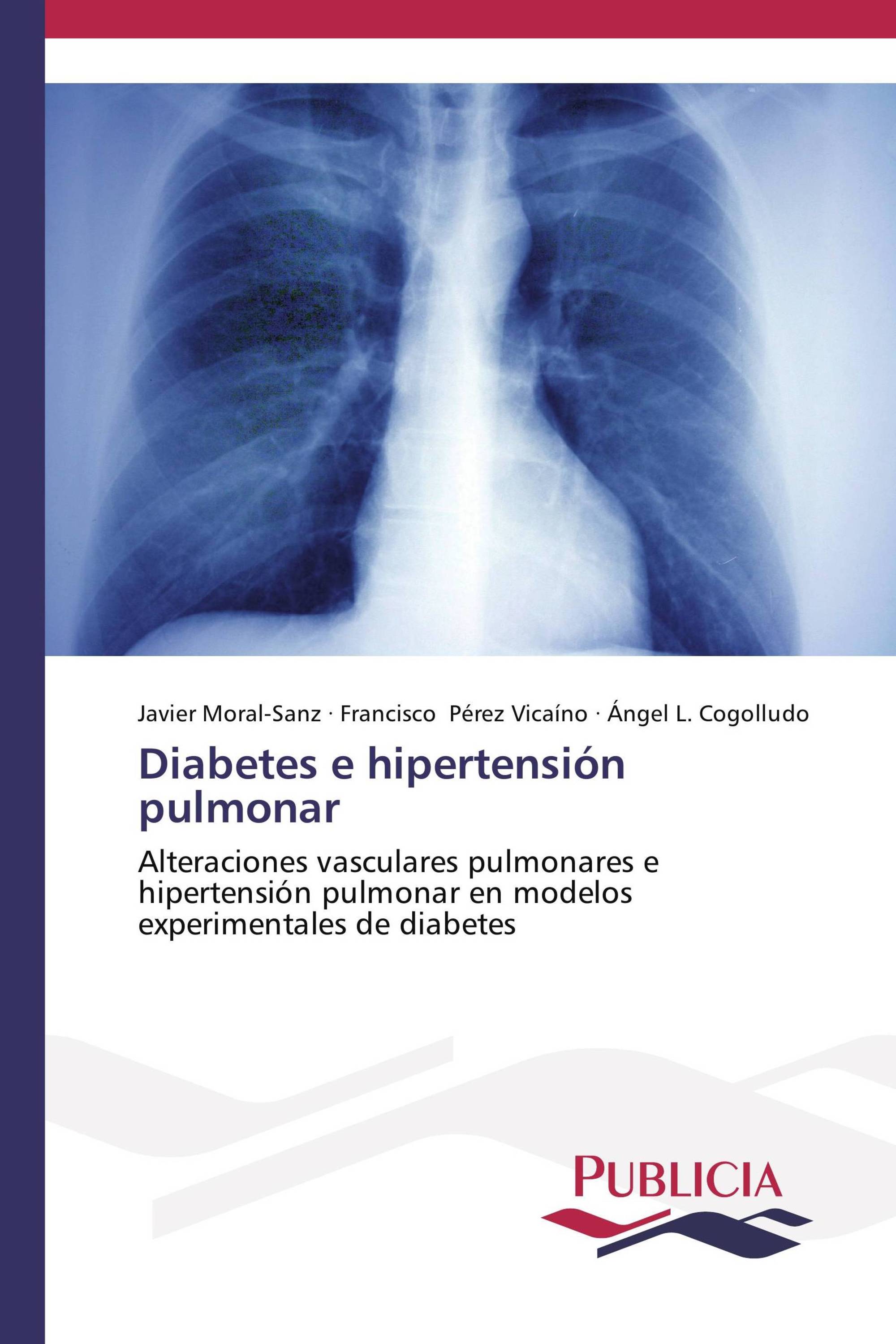 Diabetes e hipertensión pulmonar