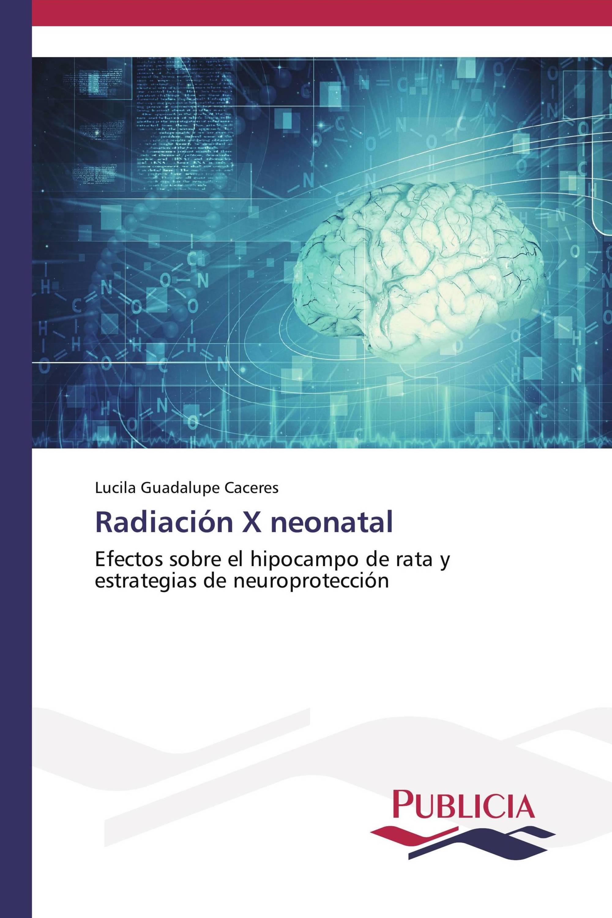 Radiación X neonatal