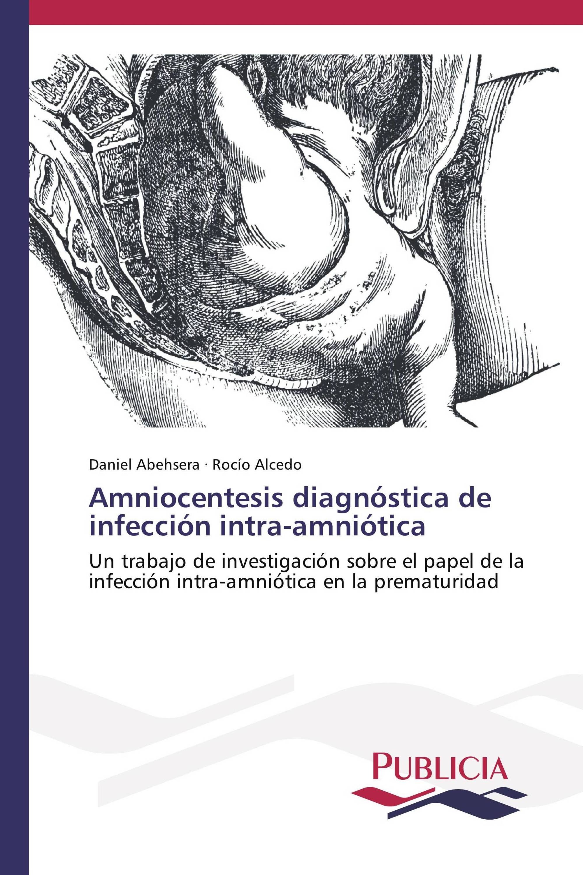 Amniocentesis diagnóstica de infección intra-amniótica