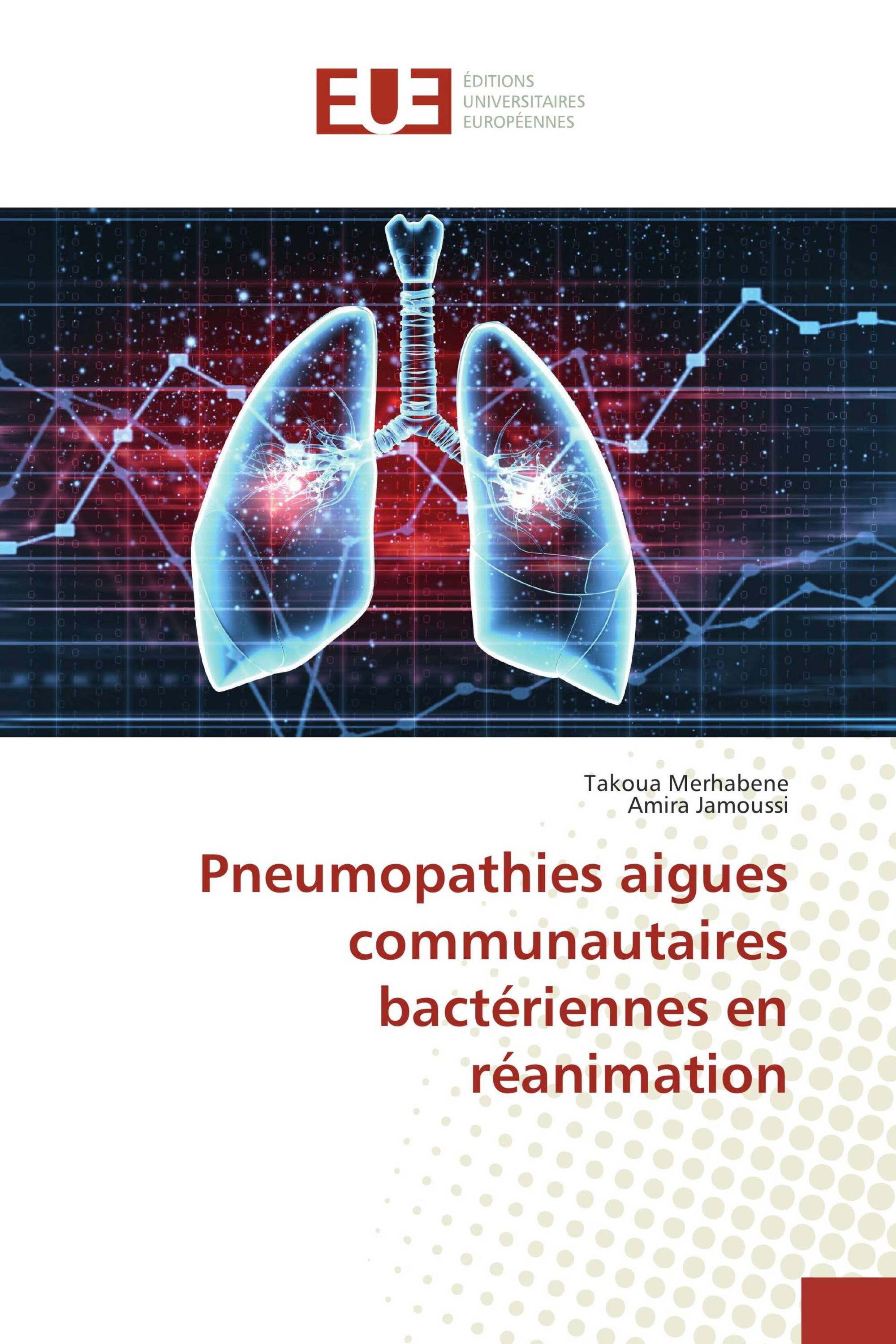 Pneumopathies aigues communautaires bactériennes en réanimation