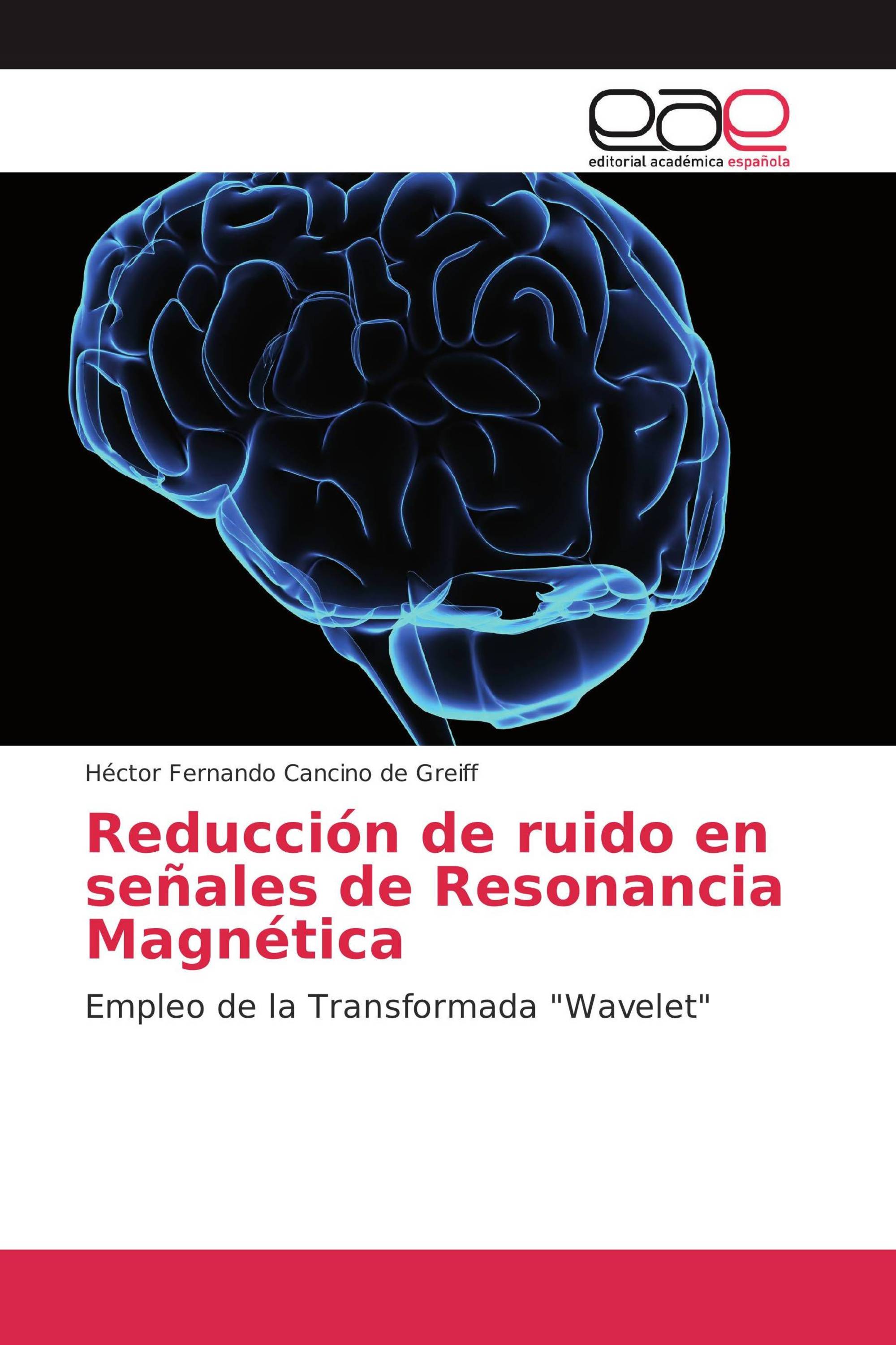 Reducción de ruido en señales de Resonancia Magnética